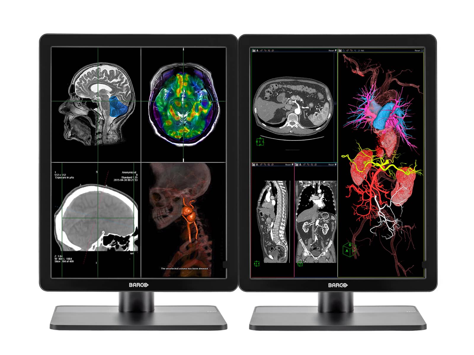 Complete PACS General Radiology Station | Barco 3MP Color LED Displays | Dell Workstation | Dictation Mic | Worklist Monitor (3421P520) Monitors.com 