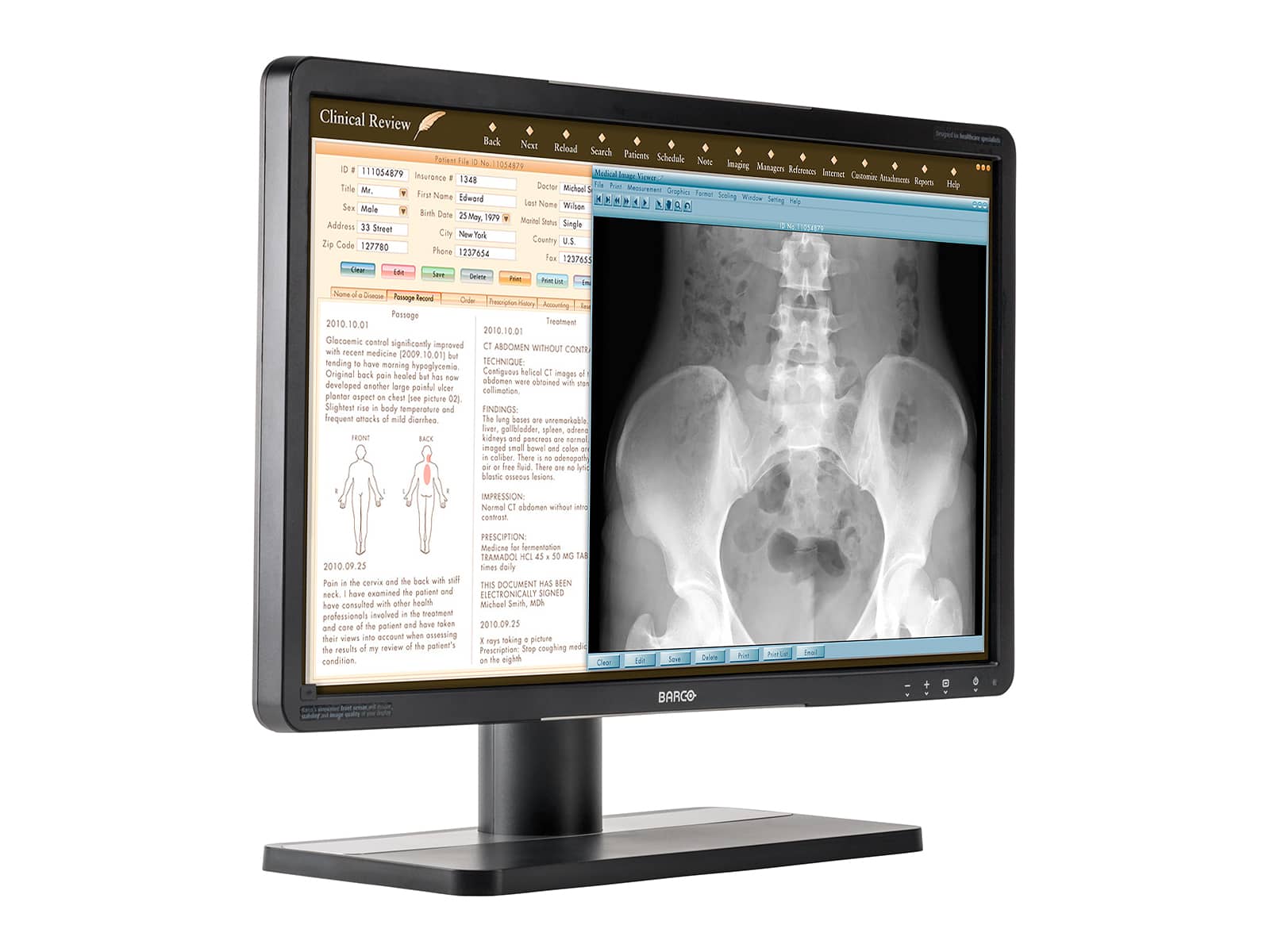 Barco Eonis MDRC-2224 WUXGA 24" 2MP Color LED Clinical Review Display Monitor Monitors.com 