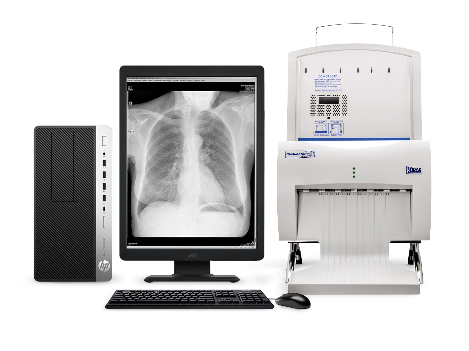 Vidar DiagnosticPro Advantage General Radiology & Mammography Film Digitizer (16333-004) Monitors.com 