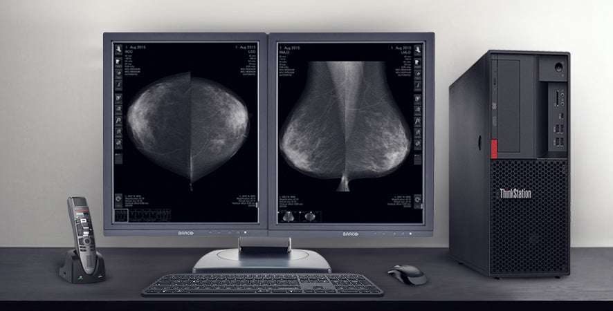 7 Überlegungen bei der Auswahl eines Mammographie-Displays