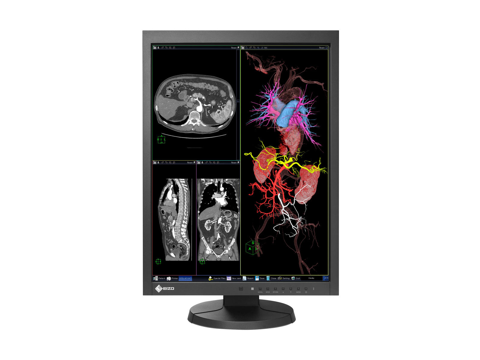 Eizo RadiForce MX215 2MP 21인치 컬러 LCD 진단 방사선학 디스플레이 모니터(MX215-BK)