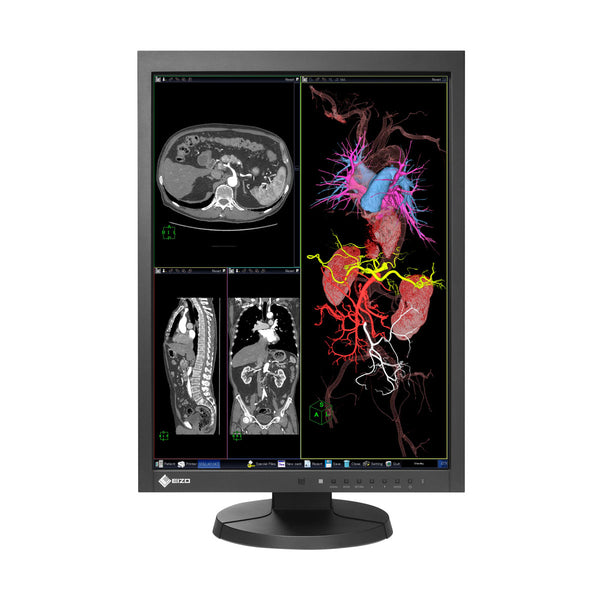 専用ページ2台セットEIZO RadiForce MX215 21.3インチ医療 1-MX215-BK_600x600_crop_center