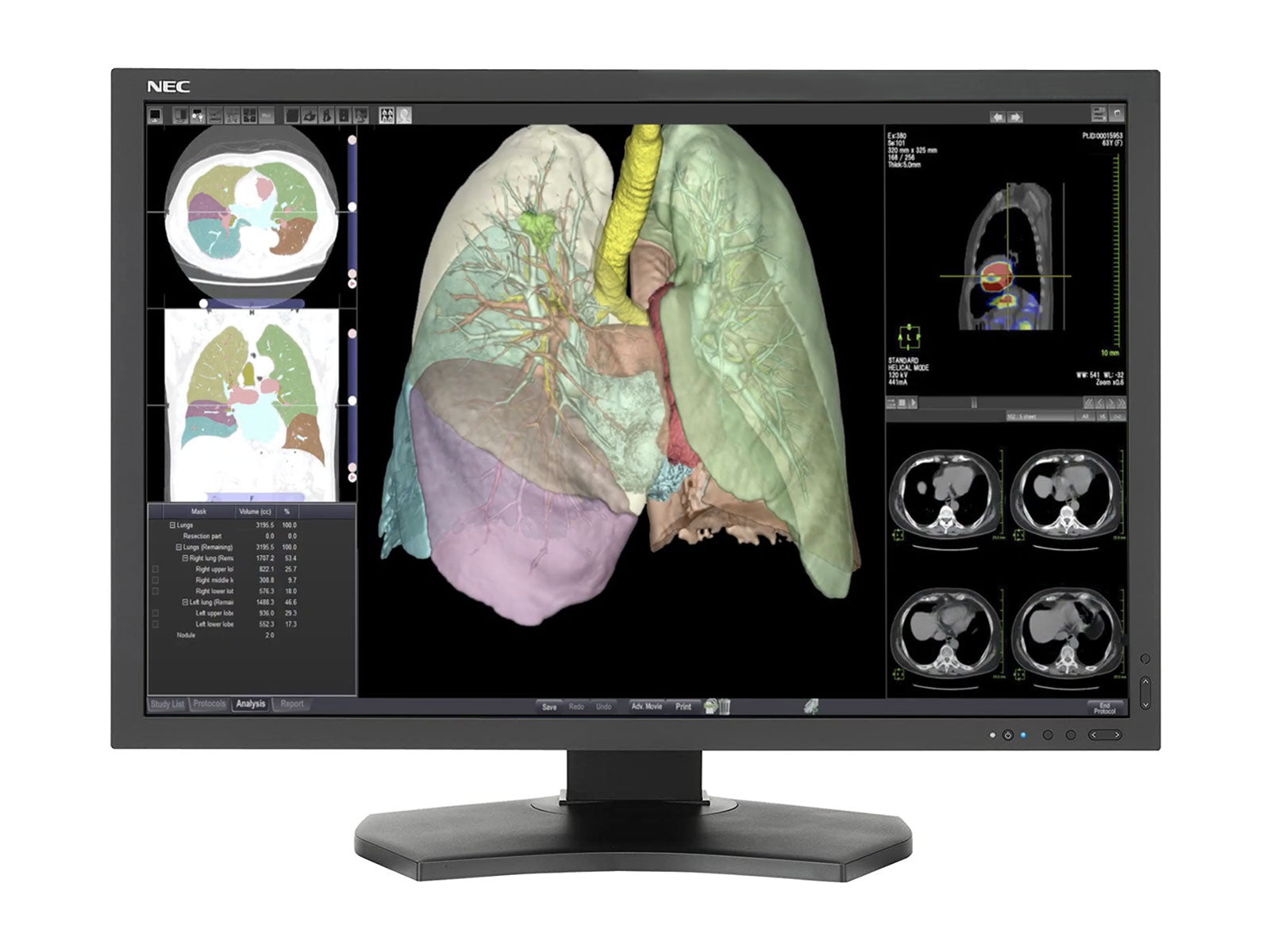 NEC MultiSync MD301C4 4MP 30" PACS-Display für allgemeine Radiologie (MD301C4)