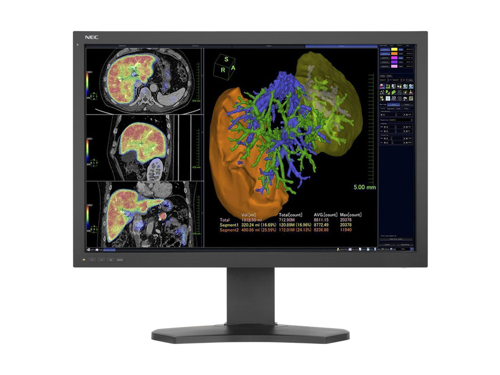 NEC MultiSync MD302C6 6MP 30" PACS-Display für allgemeine Radiologie (MD302C6)