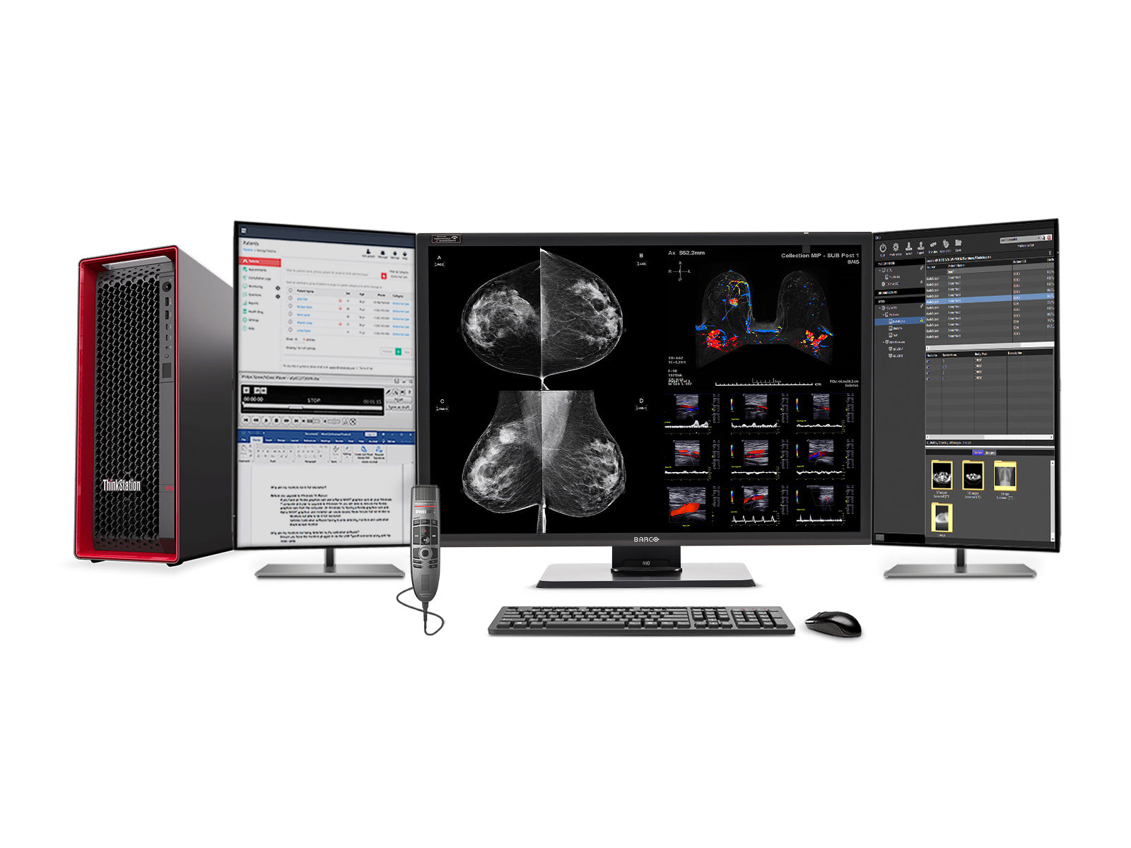 Volledige Mammografie Leesstation | Barco Nio MDNC-12130 12MP Kleur | HP Z4 G5 Werkstation | Dicatatie Microfoon | Werklijst Monitoren (12130Z4G5) 