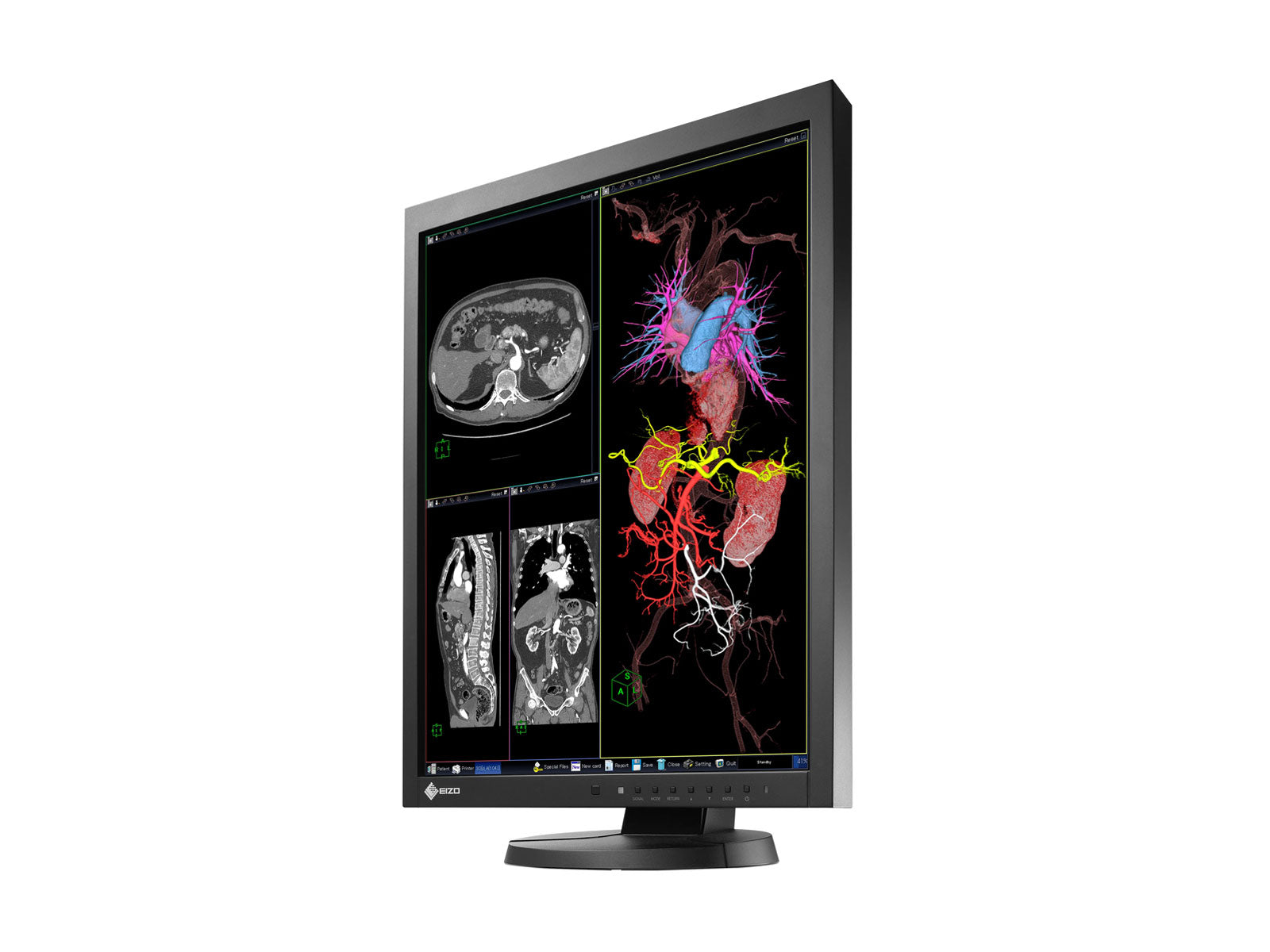 Eizo RadiForce MX215 Monitor de pantalla de radiología de diagnóstico LCD en color de 2MP y 21" (MX215-BK)