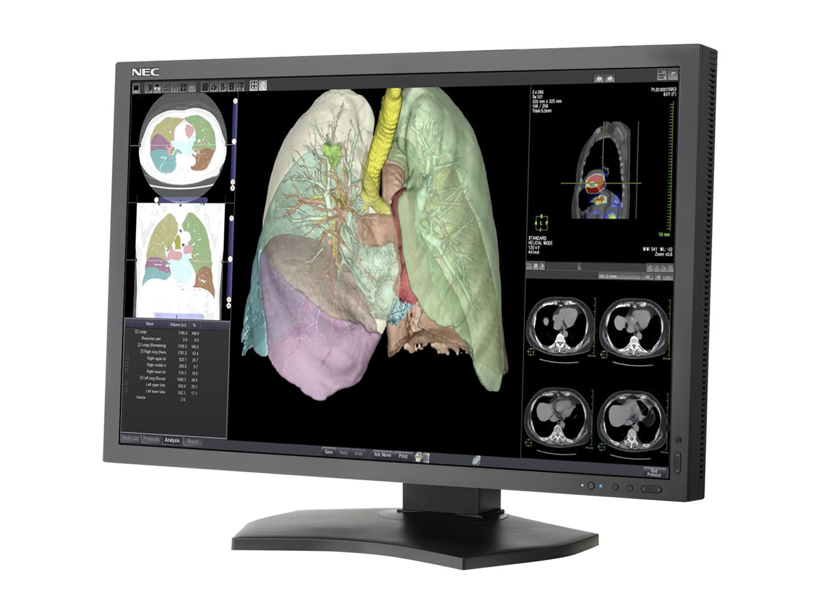 NEC MultiSync MD301C4 4MP 30" PACS-Display für allgemeine Radiologie (MD301C4)