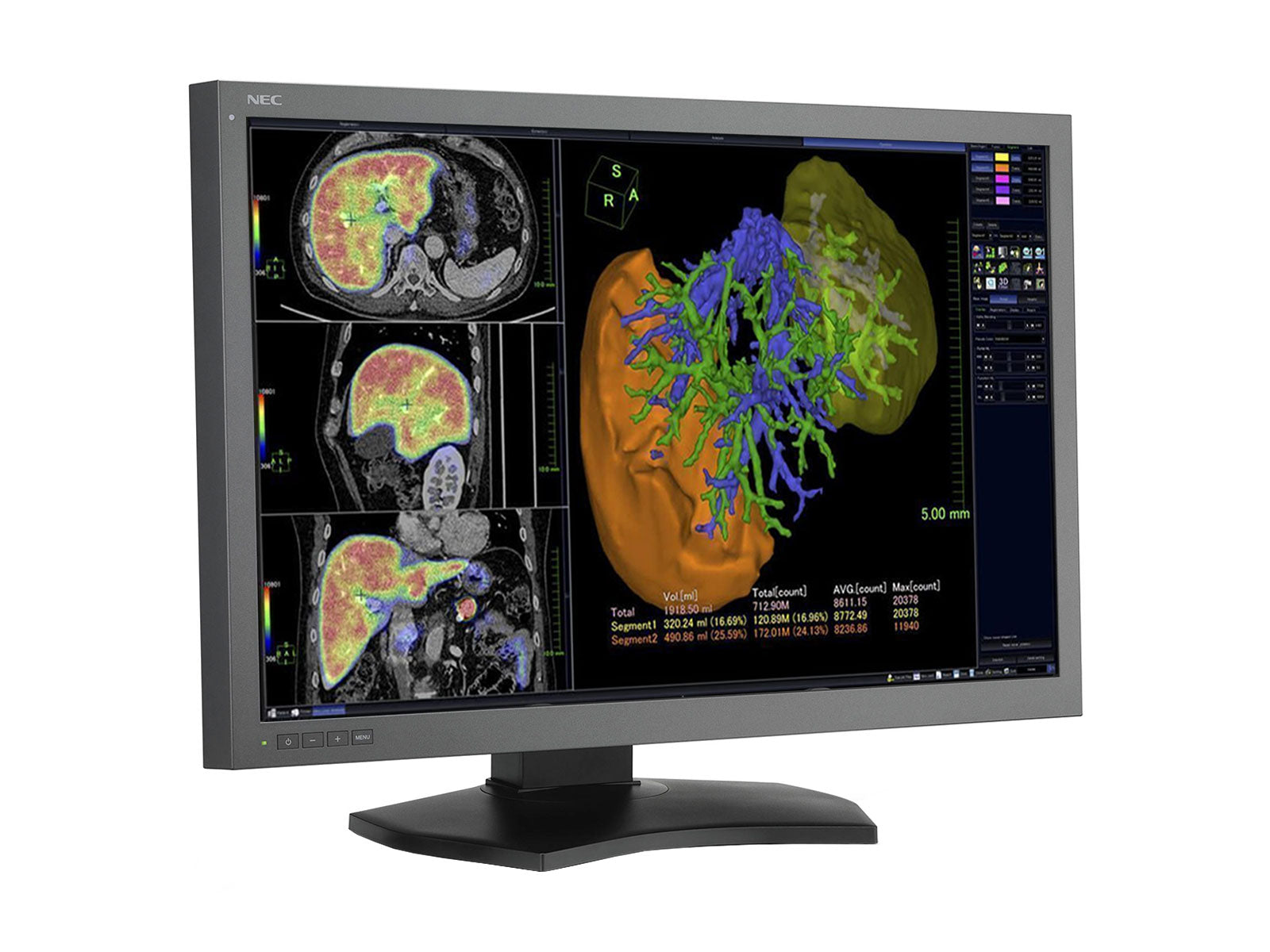 NEC MultiSync MD302C6 6MP 30" PACS-Display für allgemeine Radiologie (MD302C6)