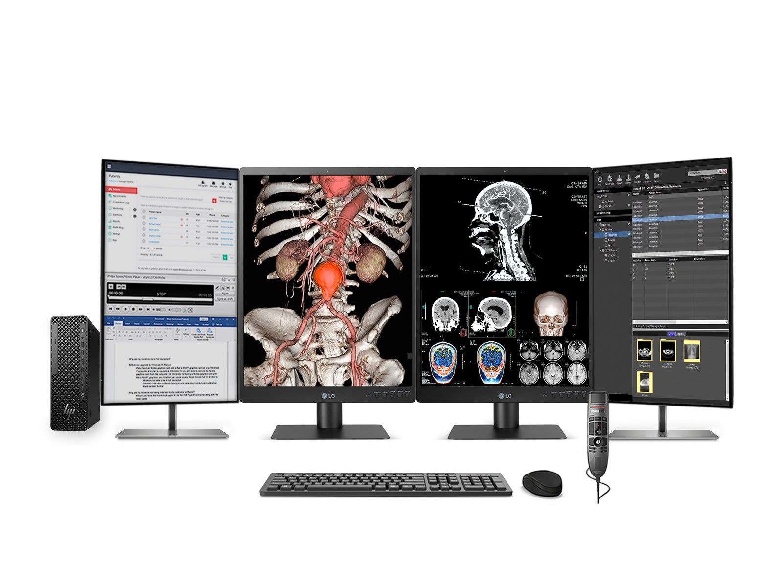 Complete PACS General Radiology Station | LG 21HQ513D 3MP 21" Color | HP Z2 G1i SFF Workstation | Dictation Mic | Worklist Monitor (21HQ513DZ2G9SFF)