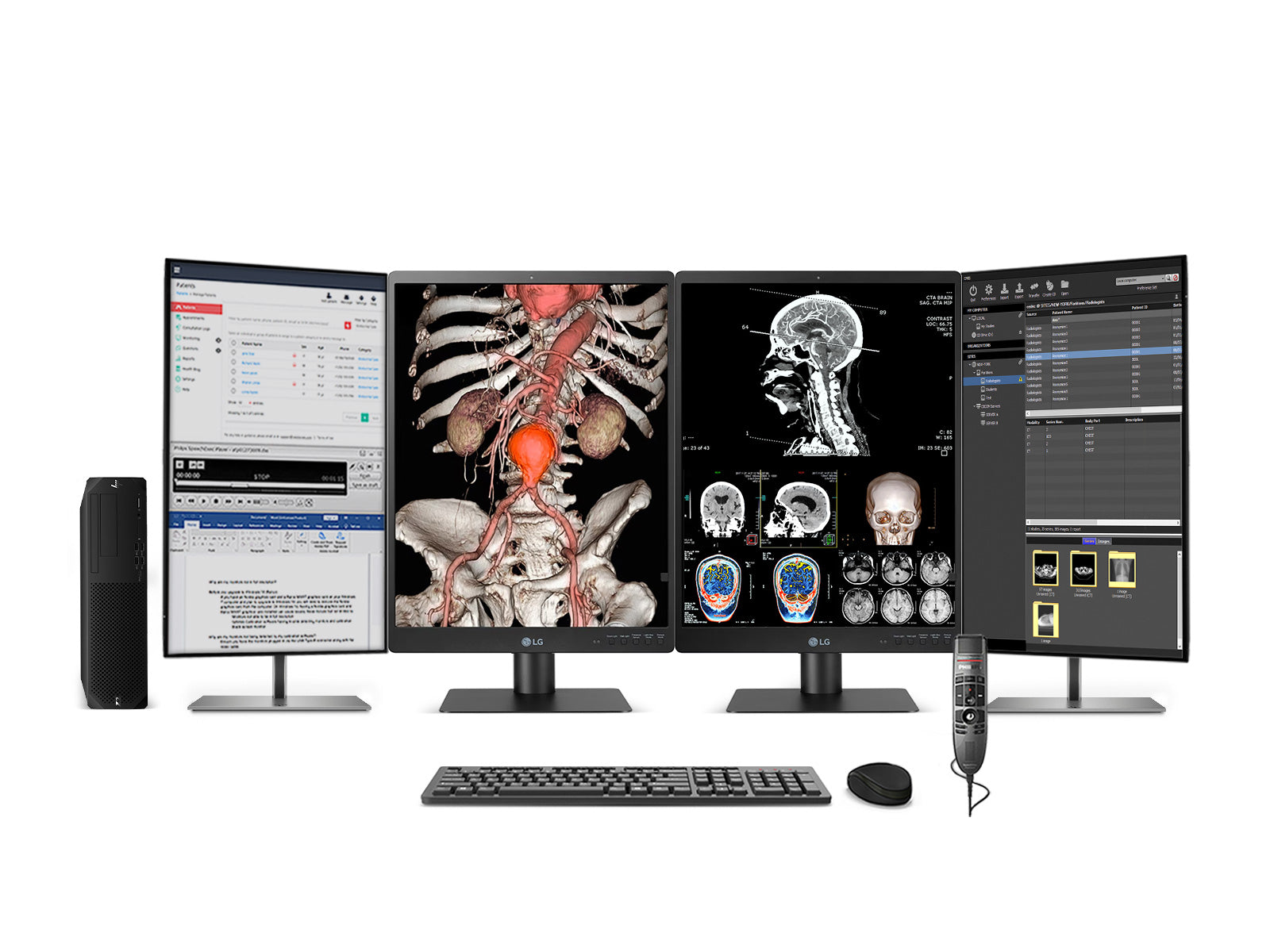 Komplette PACS-Station für allgemeine Radiologie | LG 21HQ513D 3MP 21 "Farbe | HP Z2 G9 SFF Workstation | Diktiermikrofon | Worklist Monitor (21HQ513DZ2G9SFF)