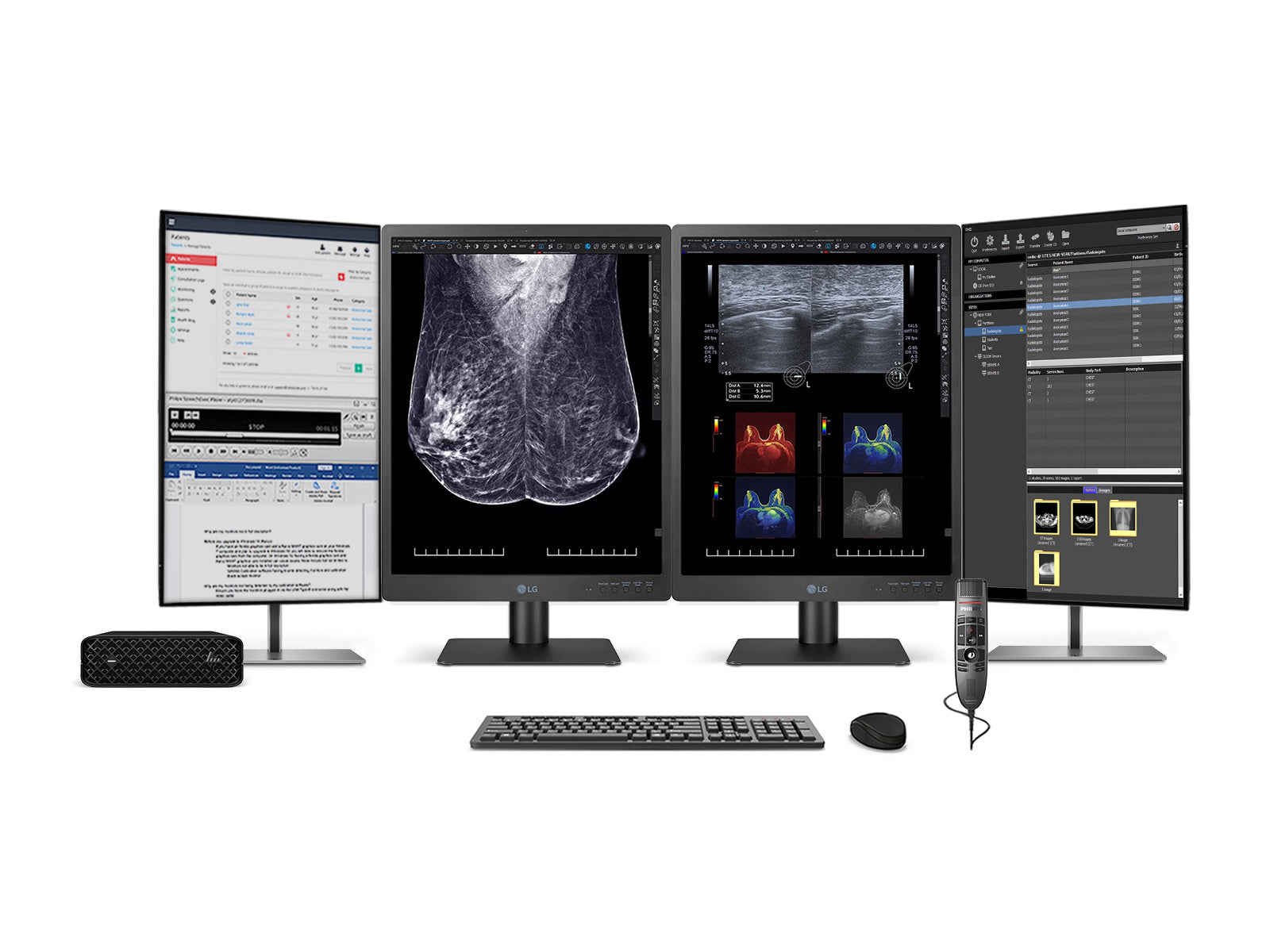 Estação de leitura de mamografia completa | LG 5MP Cor de 21 "| HP Z2 Mini G9 Estação de trabalho | ditado Mic | monitores de Worklist (21HQ613DZ2MNG9)