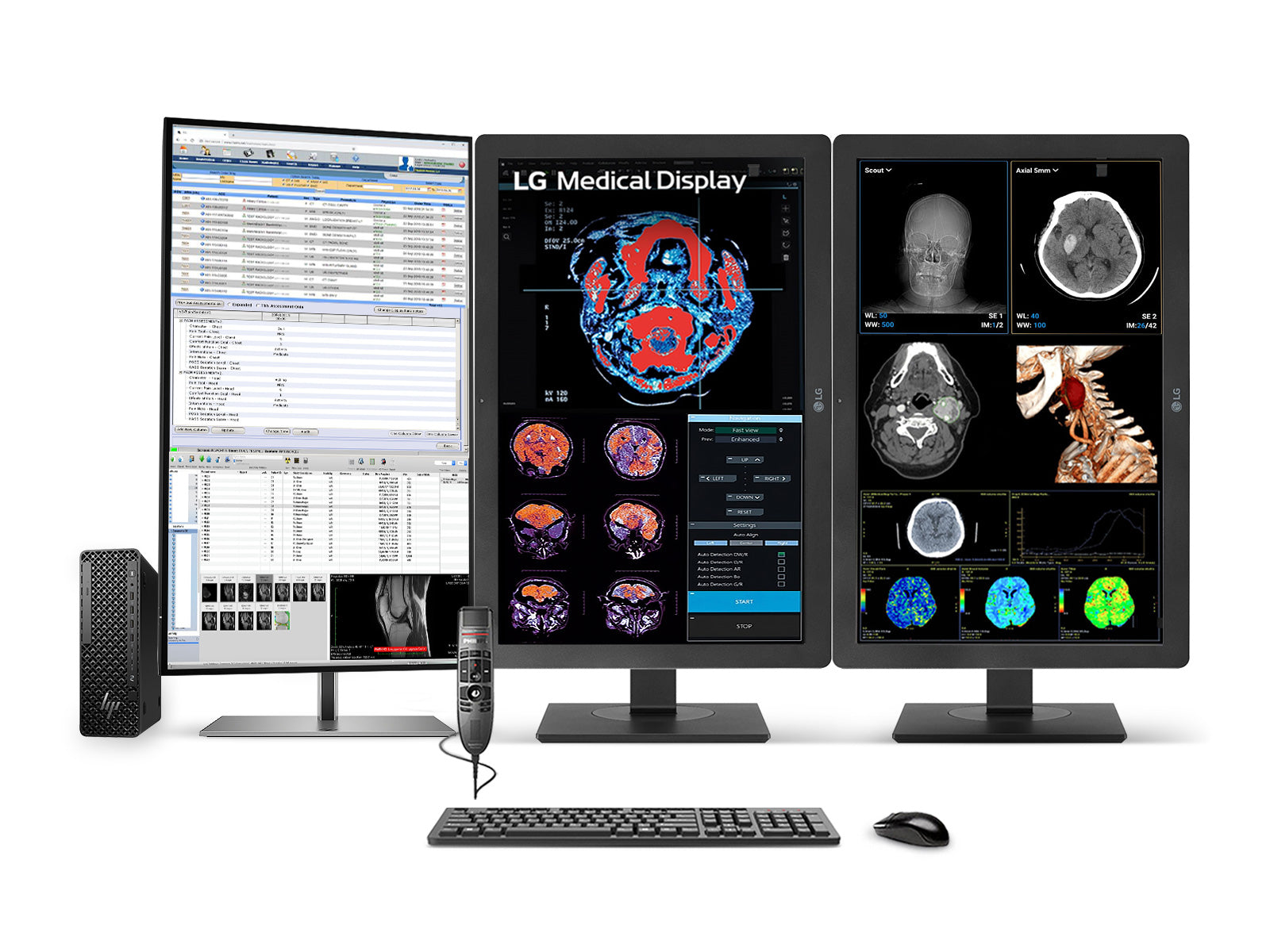 Complete PACS General Radiology Station | Dual LG 24" Color 2MP | HP Z2 SFF G1i Workstation | Dictation Mic | Worklist Monitor (24HR513CP3T)