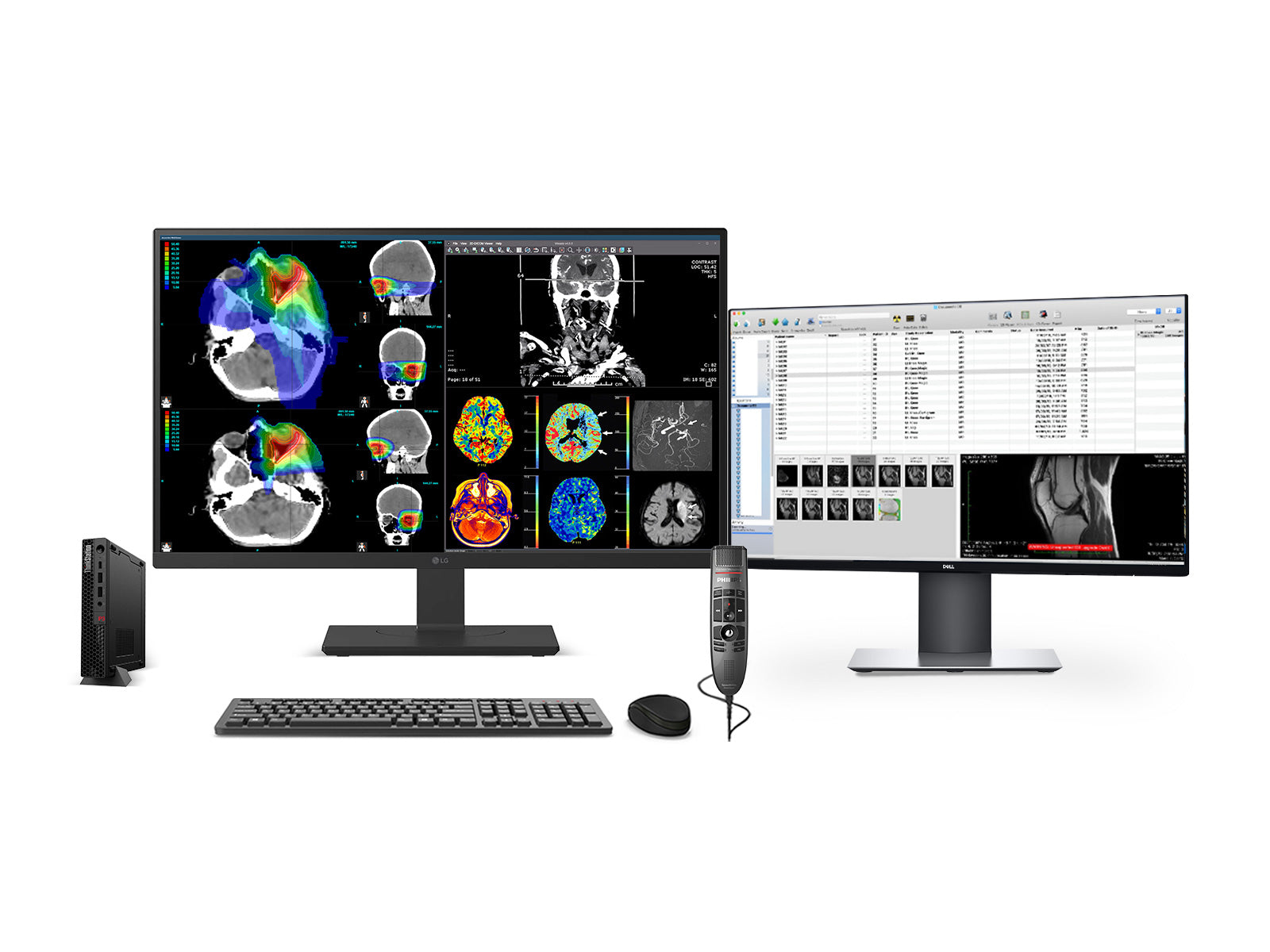 Estación de Radiología General PACS Completa | LG Fusión de colores de 27" 8MP 4K | Lenovo ThinkStation P3 Tiny Estación de trabajo | Micrófono de dictado | Monitor de lista de trabajo (27HS713CP3T)