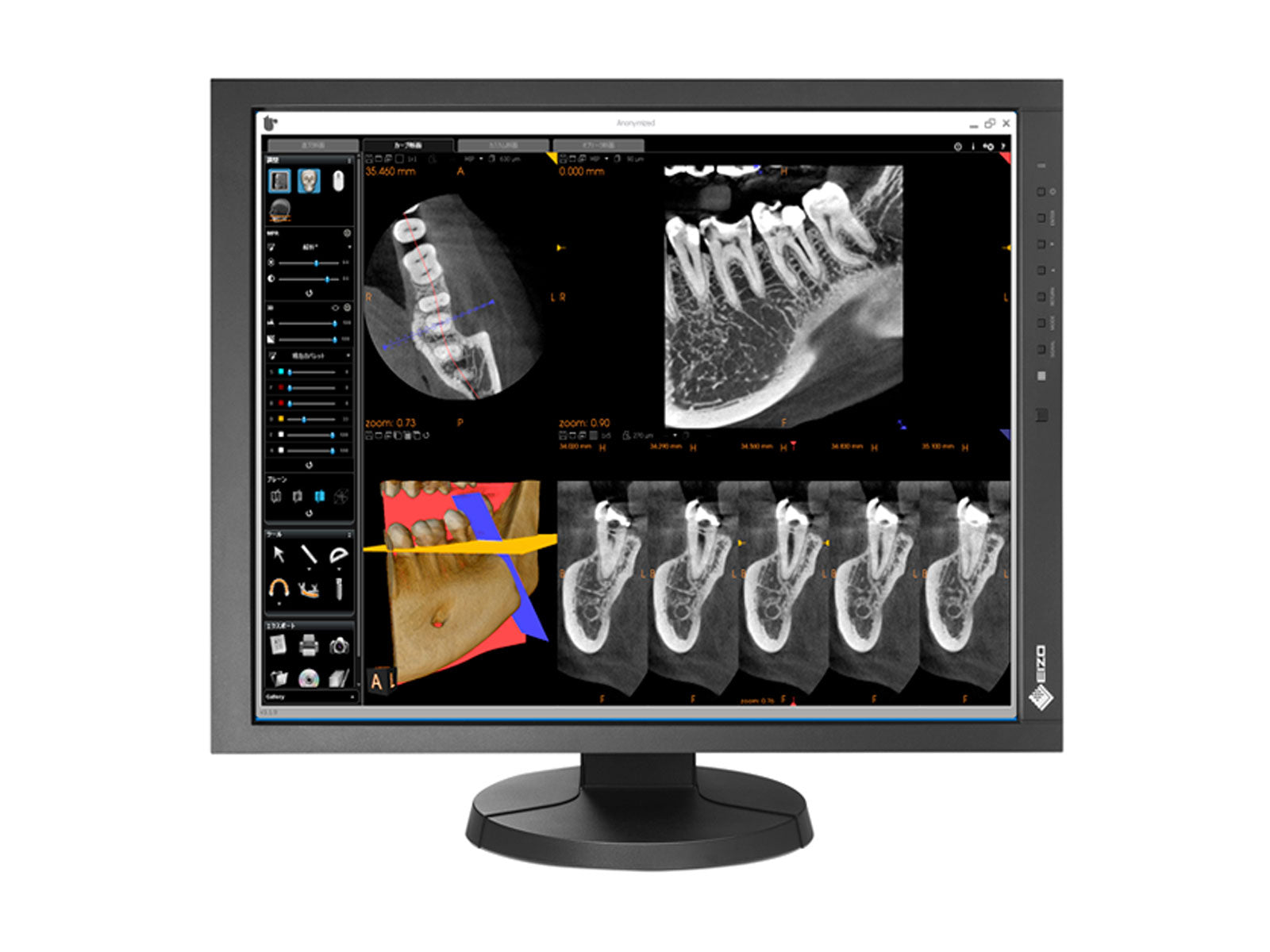 Eizo RadiForce MX215 2MP 21" Farb-LCD-Diagnose-Radiologie-Display-Monitor (MX215-BK)
