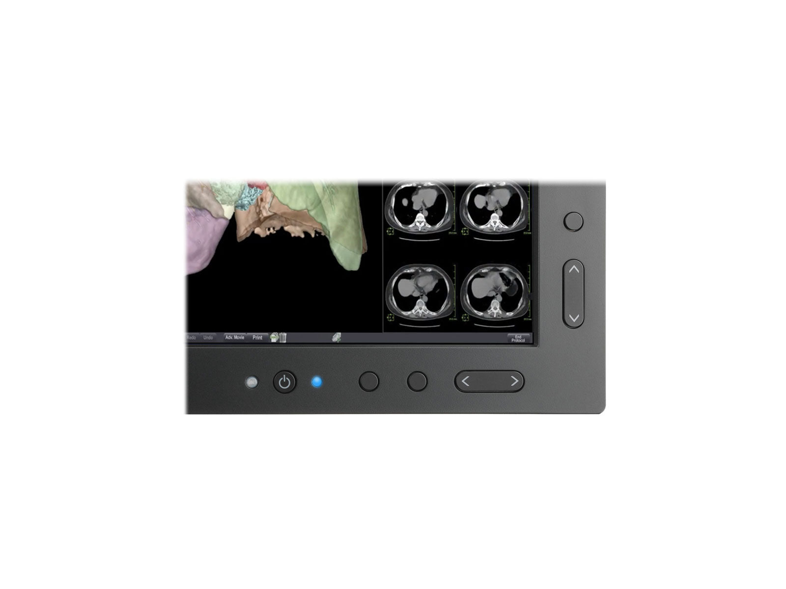NEC MultiSync MD301C4 4MP 30" PACS-Display für allgemeine Radiologie (MD301C4)