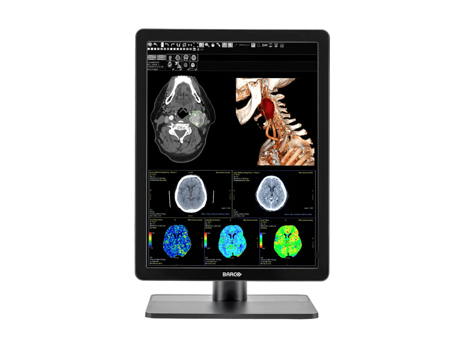 Barco Nio MDNC-3421 3MP 21.3" Color LED General Radiology PACS Display