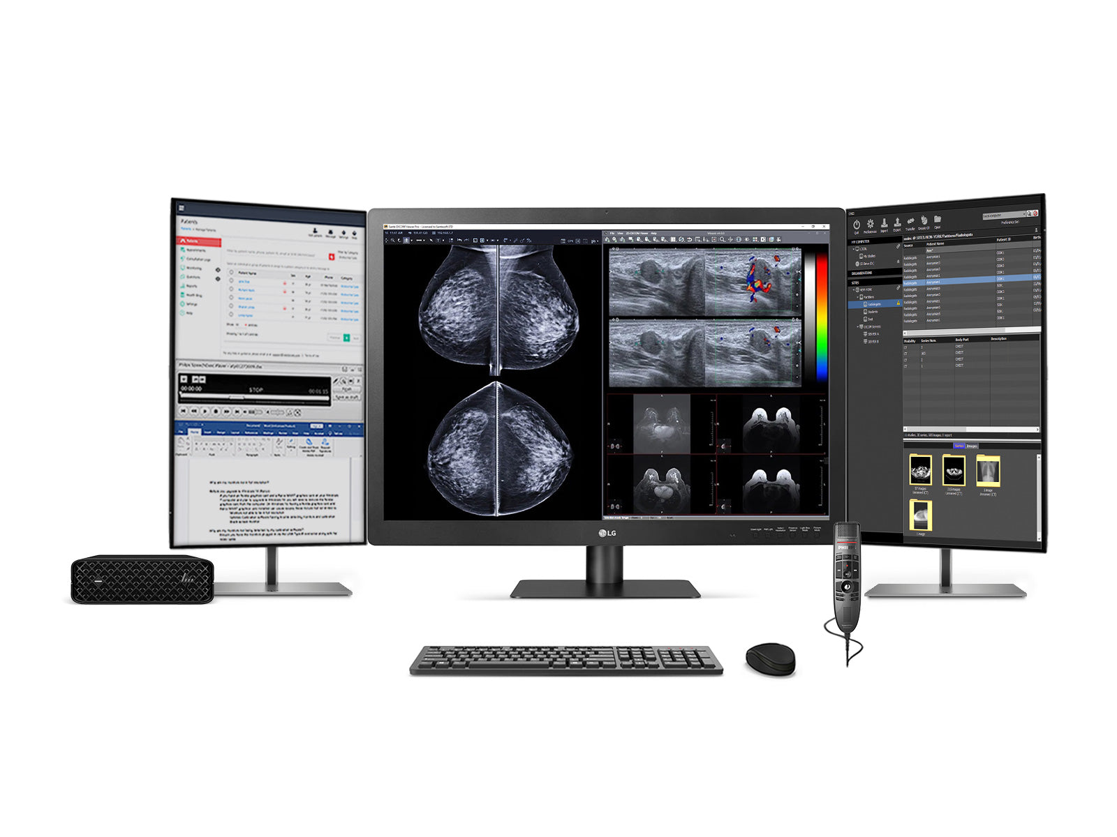 Complete mammografie leesstation | LG 12MP Fusie 31.5 "kleur | HP Z2 Mini G9 Werkstation | Dictatie MIC | Werklijstmonitors (31Hn713DZ2Mng9)