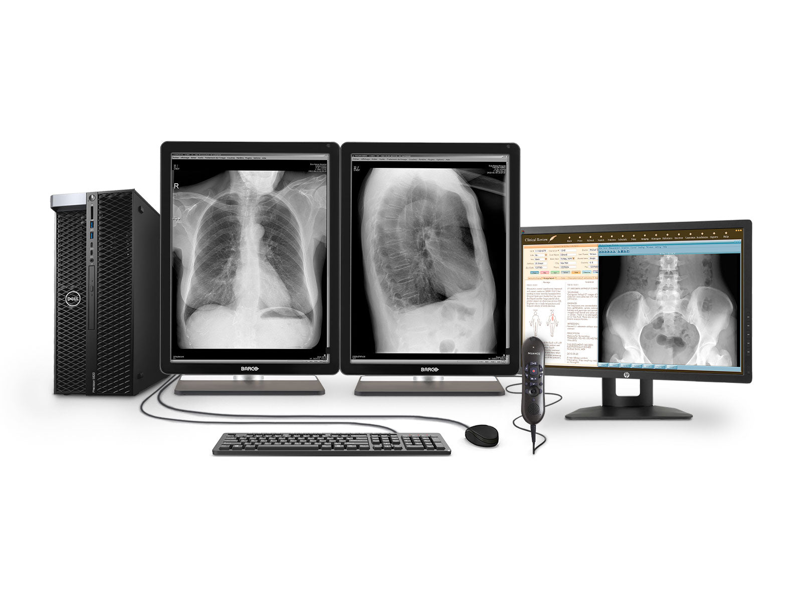 Complete PACS General Radiology Station | Barco 3MP Grayscale LED Displays | Dell Workstation | Dictation Mic | Worklist Monitor (3221T5820R)