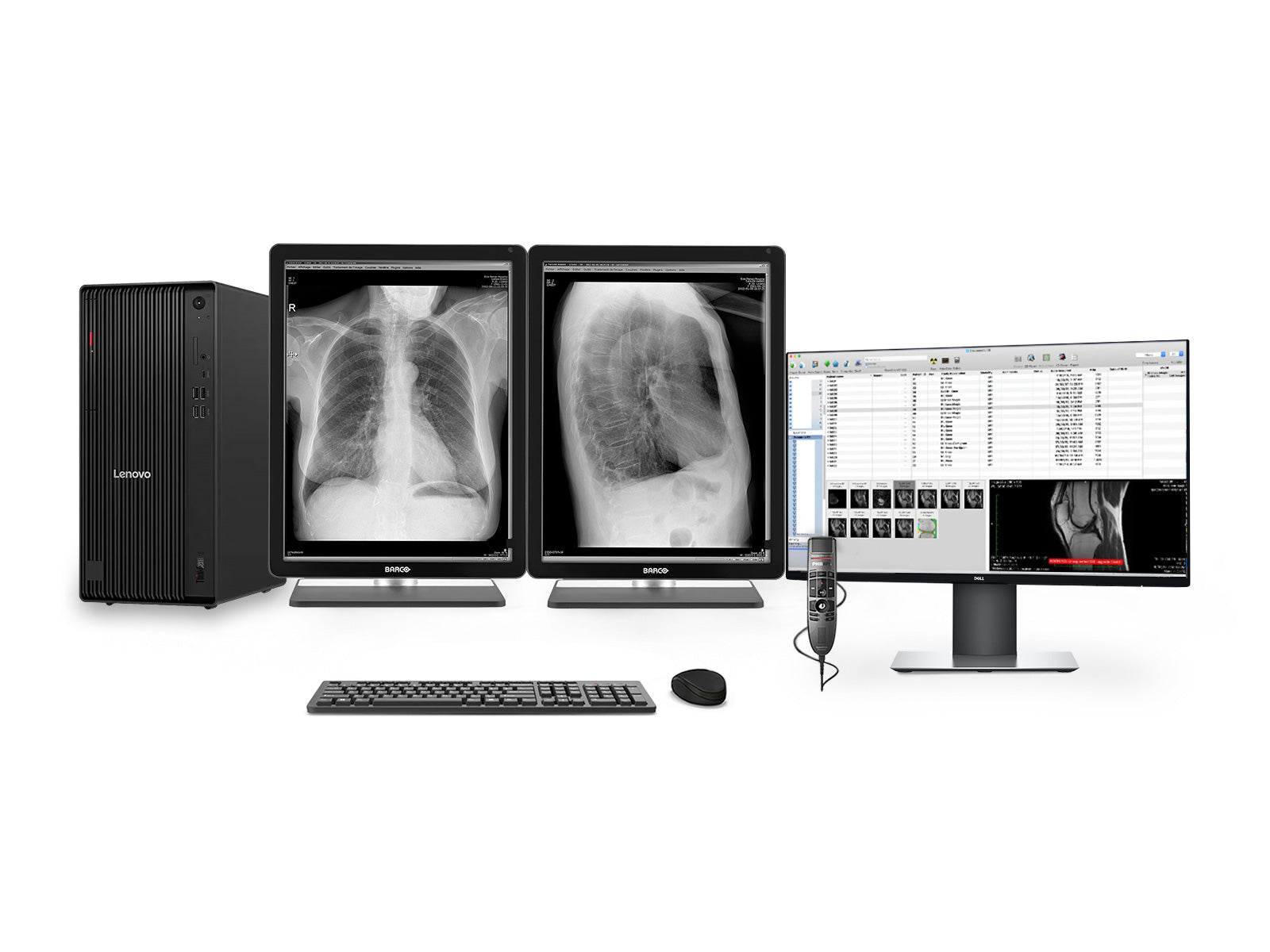 Complete PACS General Radiology Station | Barco Coronis MDCG-3221 3MP Grayscale LED Displays | Lenovo Workstation | Dictation Mic | Worklist Monitor (3221Z4R)