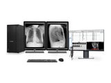 Vollständige PACS Allgemeinradiologie-Station | Barco Coronis MDCG-3221 3MP Graustufen-LED-Displays | Lenovo Arbeitsstation | Diktiermikrofon | Arbeitslisten-Monitor (3221Z4R)