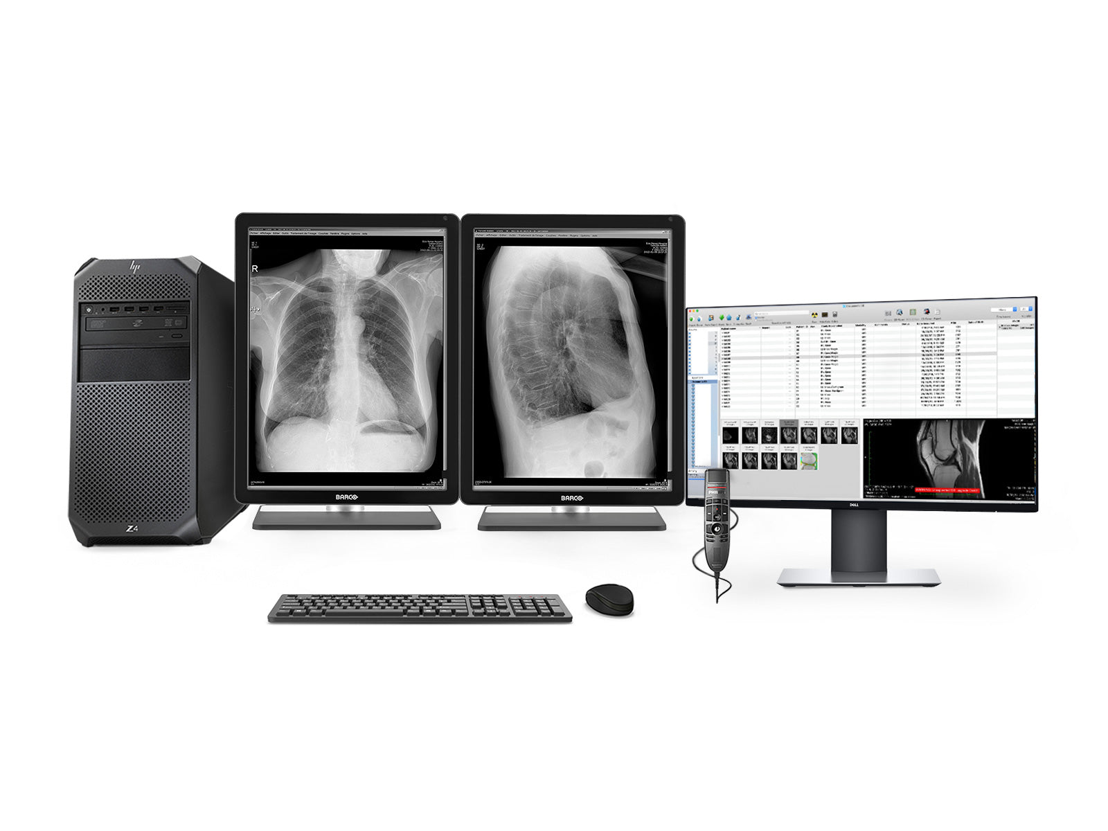 Completo PACS Estação de Radiologia Geral | Barco Coronis MDCG-3221 3MP Ecrãs LED em Escala de Cinza | Lenovo Estação de Trabalho | Microfone de Ditado | Monitor de Lista de Trabalho (3221Z4R) 