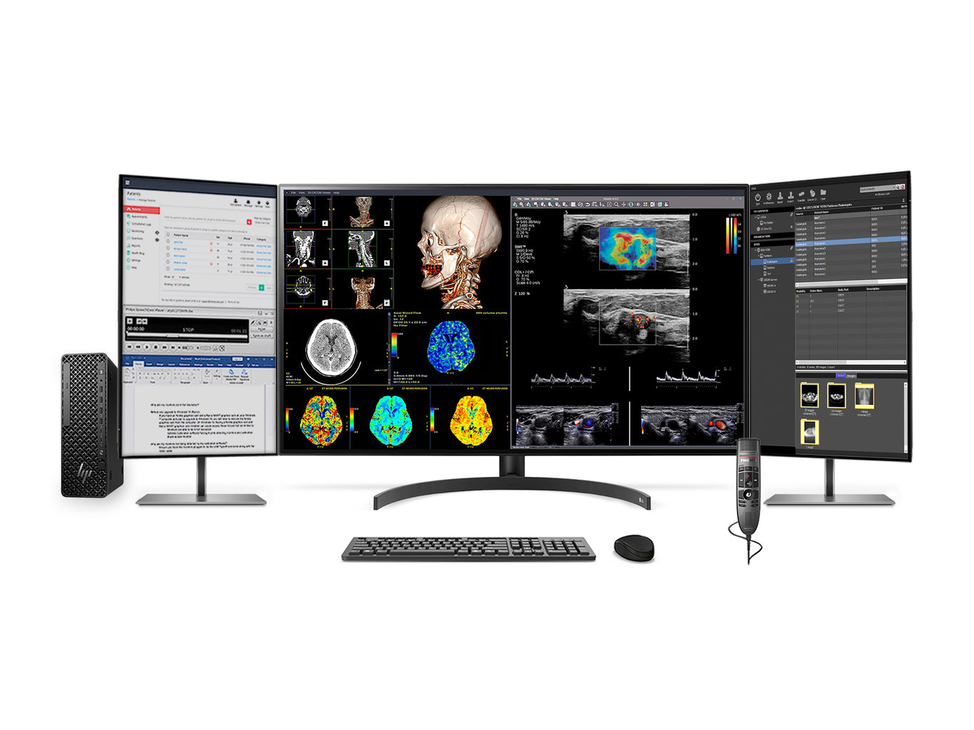 Complete PACS Gen Radiology Station - LG & HP Workstations