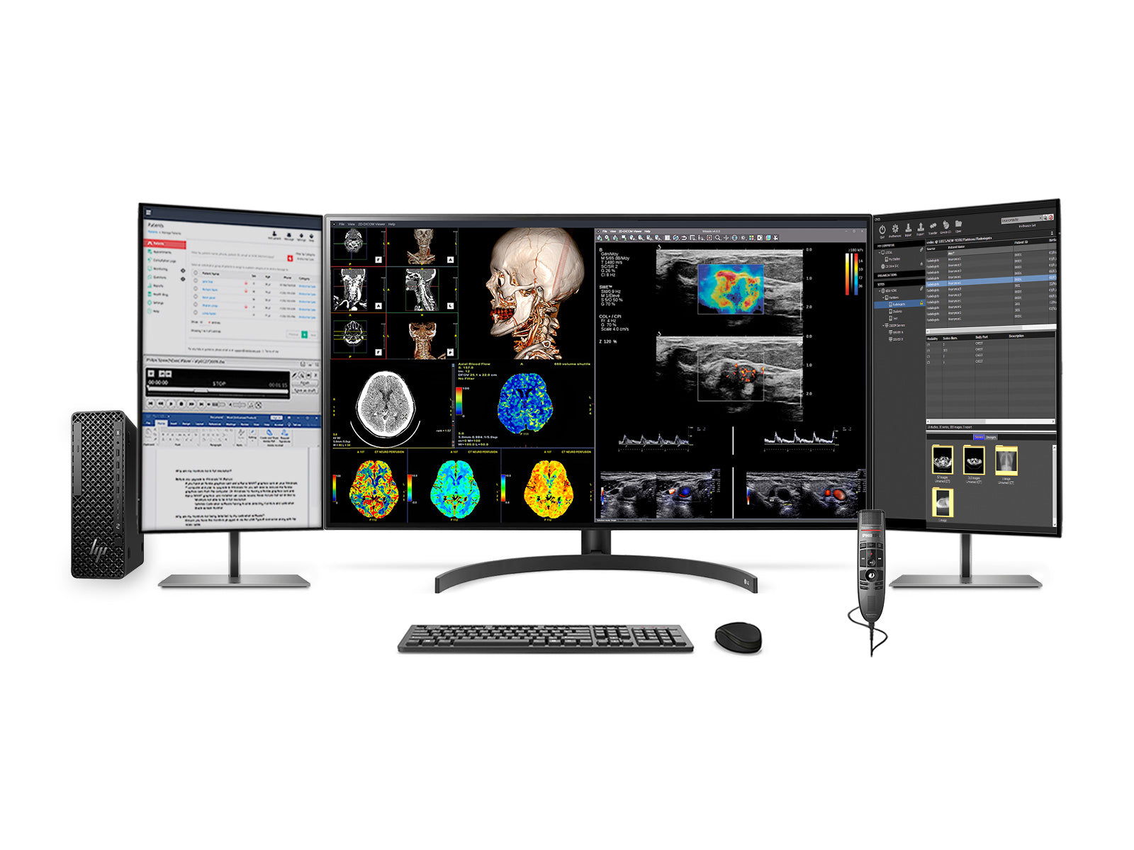 Complete PACS General Radiology Station | LG 32HL512D 8MP 32" Diagnostic Fusion Color | HP Z2 SFF G1i Workstation | Dictation Mic | Worklist Monitor (32HL512DZ2G9SFF)