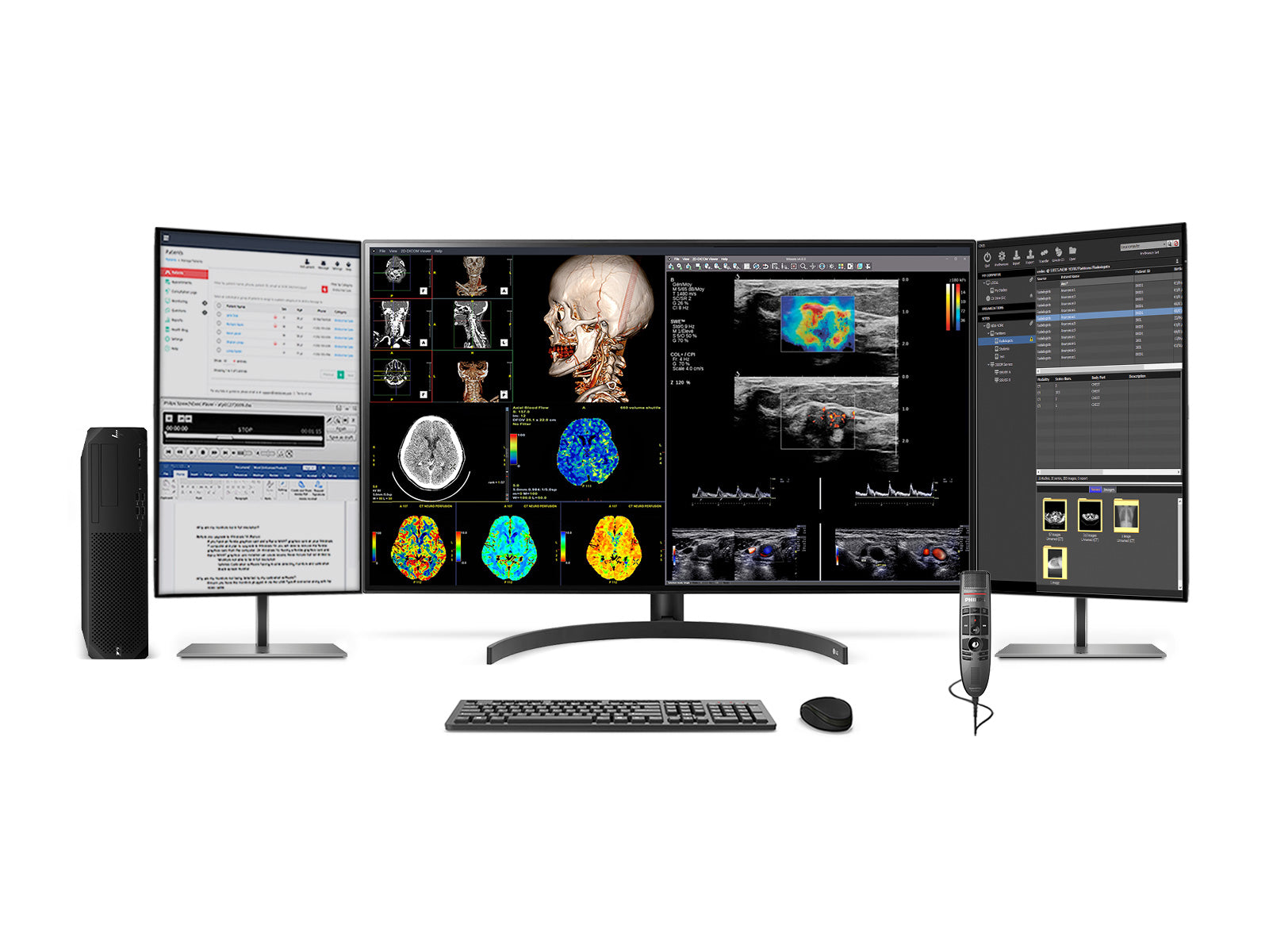 Komplette PACS-Station für allgemeine Radiologie | LG 32HL512D 8MP 32 "Diagnostische Fusionsfarbe | HP Z2 G9 SFF Workstation | Diktiermikrofon | Worklist Monitor (32HL512DZ2G9SFF)