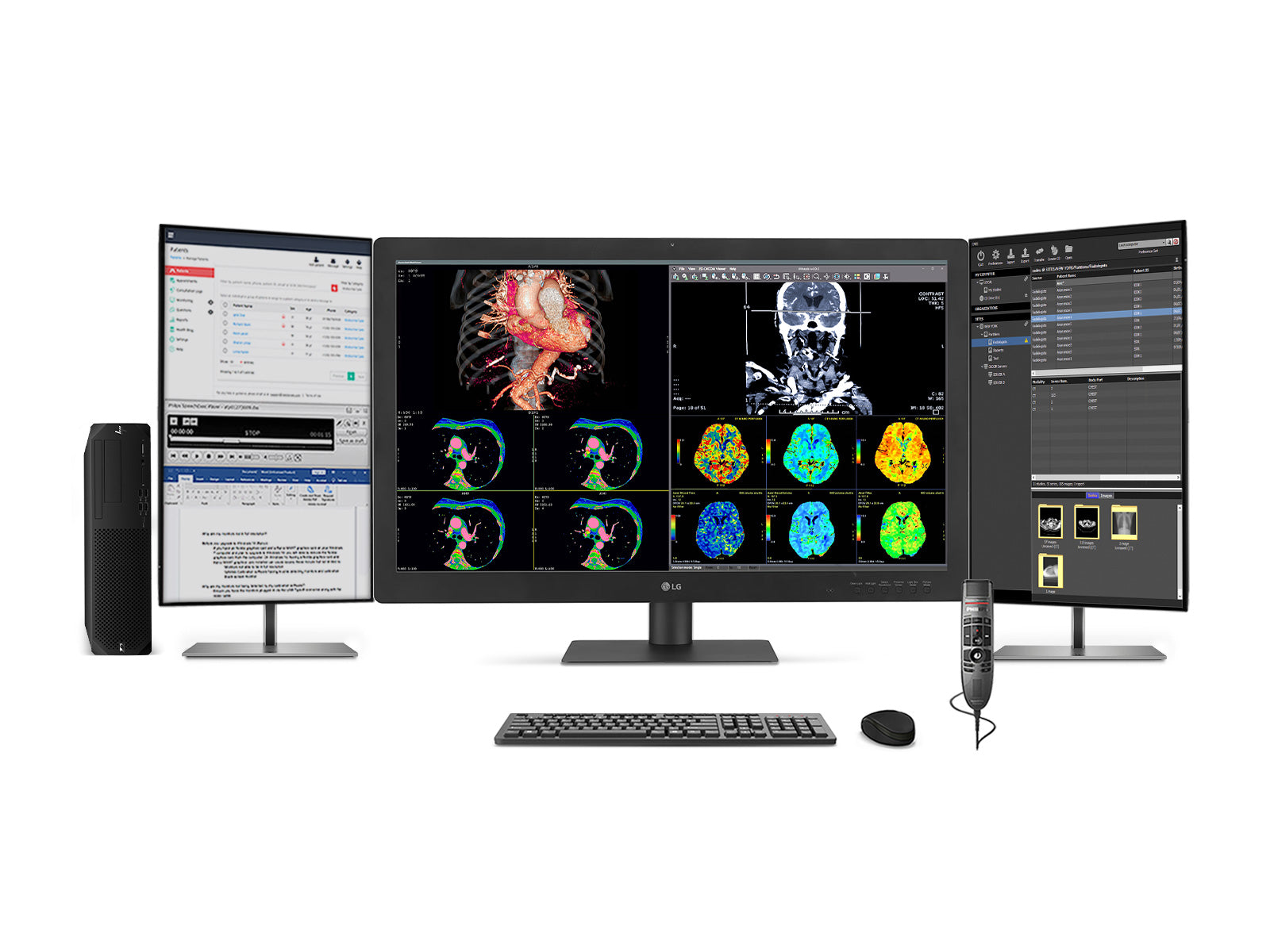 Komplette PACS-Station für allgemeine Radiologie | LG 32HQ713D 8MP 32 "Diagnostische Fusionsfarbe | HP Z2 G9 SFF Workstation | Diktiermikrofon | Worklist Monitor (32HQ713DZ2G9SFF)