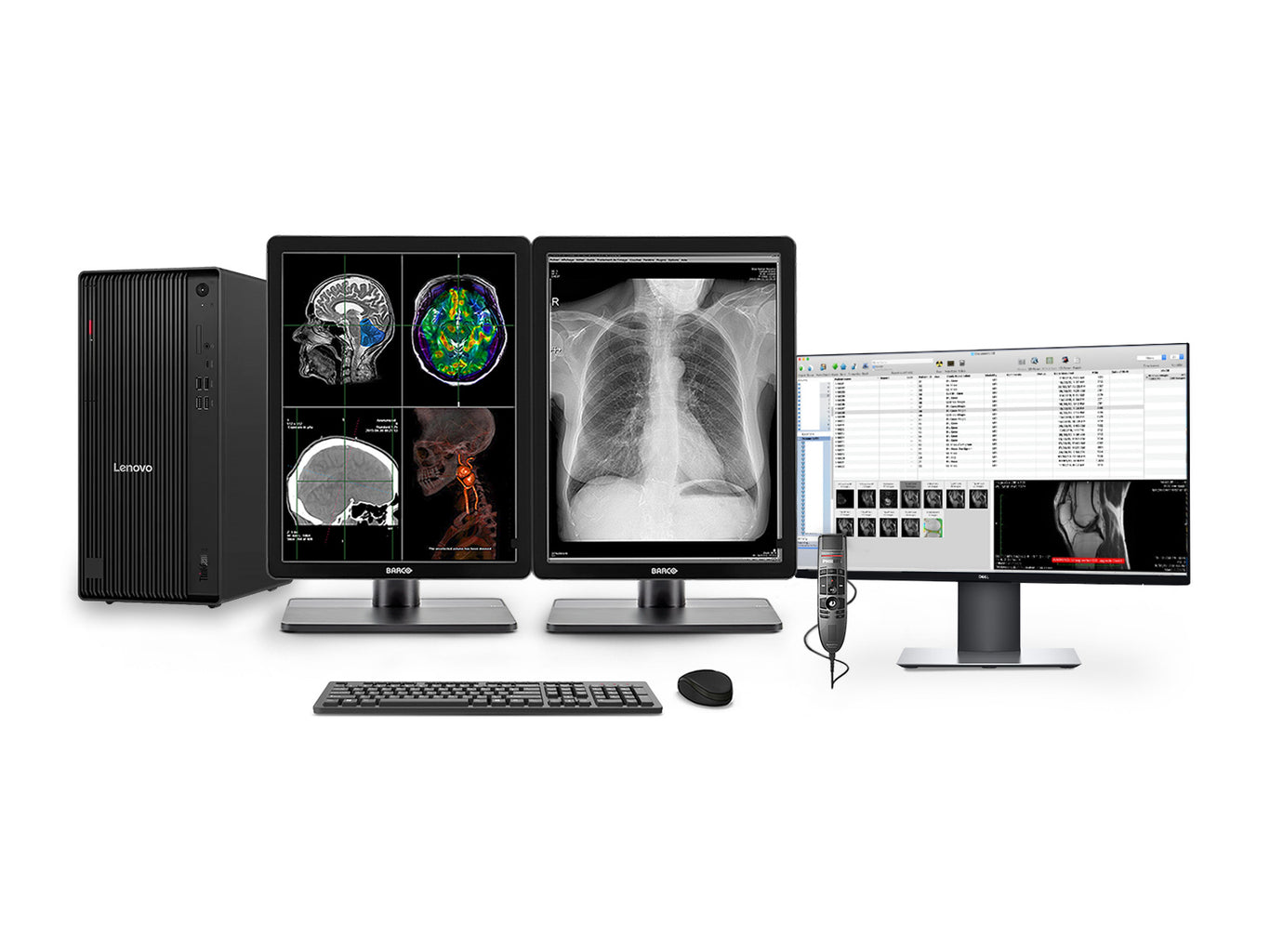 Complete PACS General Radiology Station | Lenovo Workstation