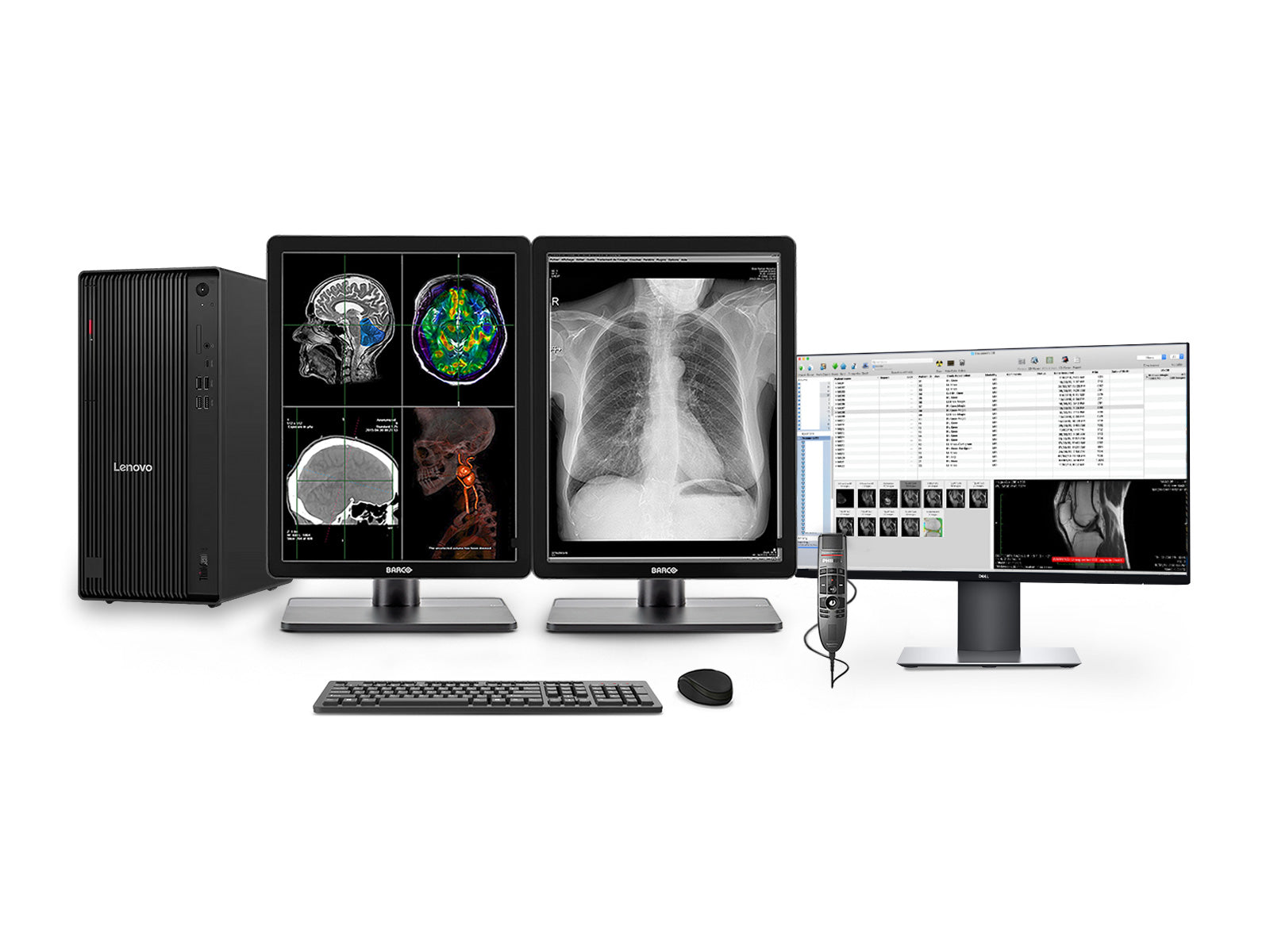 Complete PACS General Radiology Station | Barco Nio MDNC-3321 3MP Color LED Displays | Lenovo Workstation | Dictation Mic | Worklist Monitor (3321Z4R)