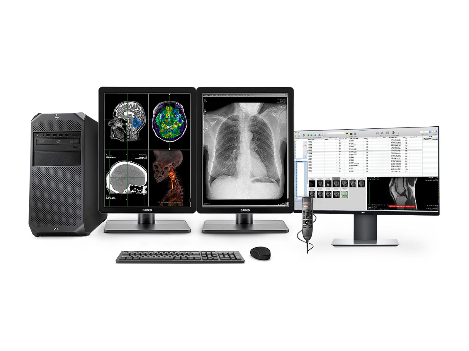 Komplette PACS General Radiology Station | Barco NIO MDNC-3321 3MP Farb -LED -Anzeigen | HP Workstation | Diktatmikrofon | Work List Monitor (3321Z4R)