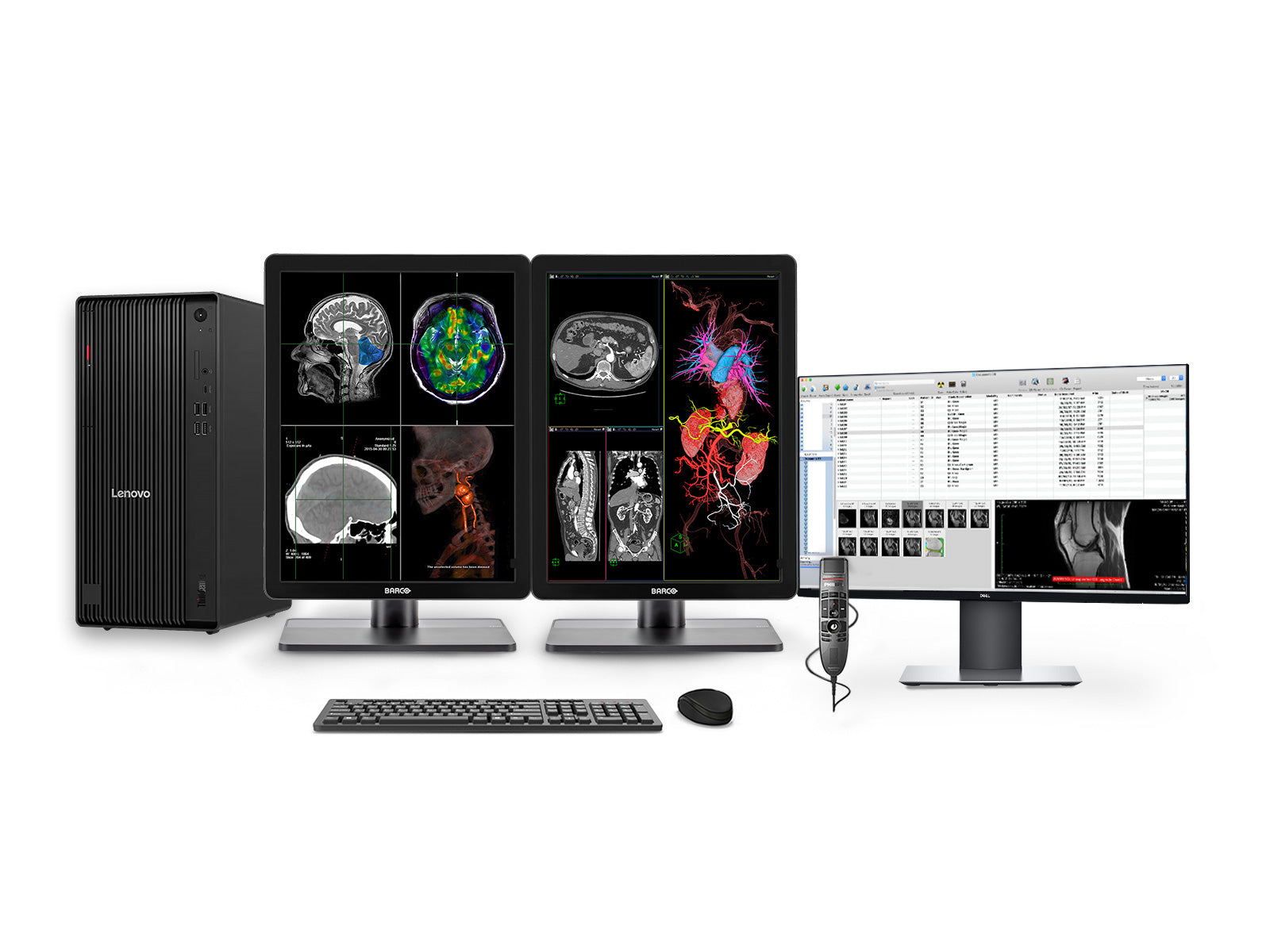 Complete PACS General Radiology Station | Barco Nio MDNC-3421 3MP Color LED Displays | Lenovo Workstation | Dictation Mic | Worklist Monitor (3421Z4R)