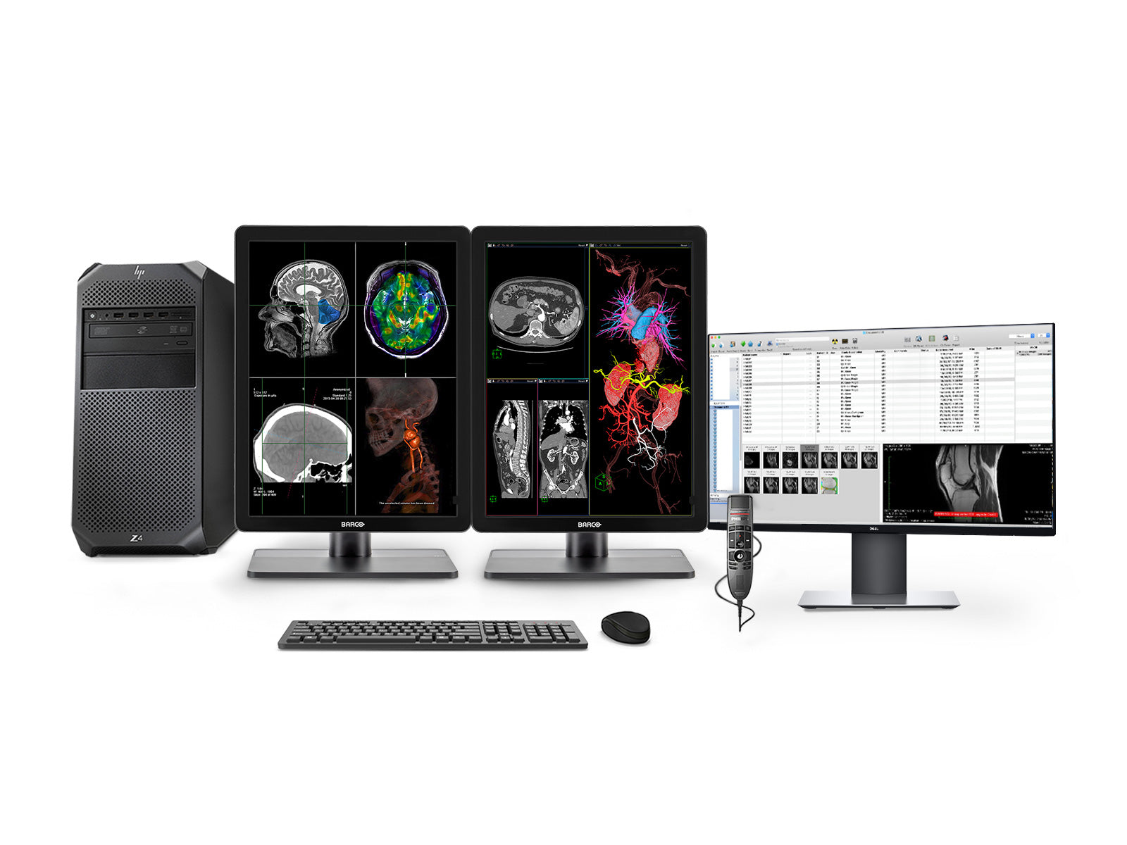 Bresco Pac Module Complete PACS General Radiology Station | Barco Nio MDNC-3421 3MP Colo