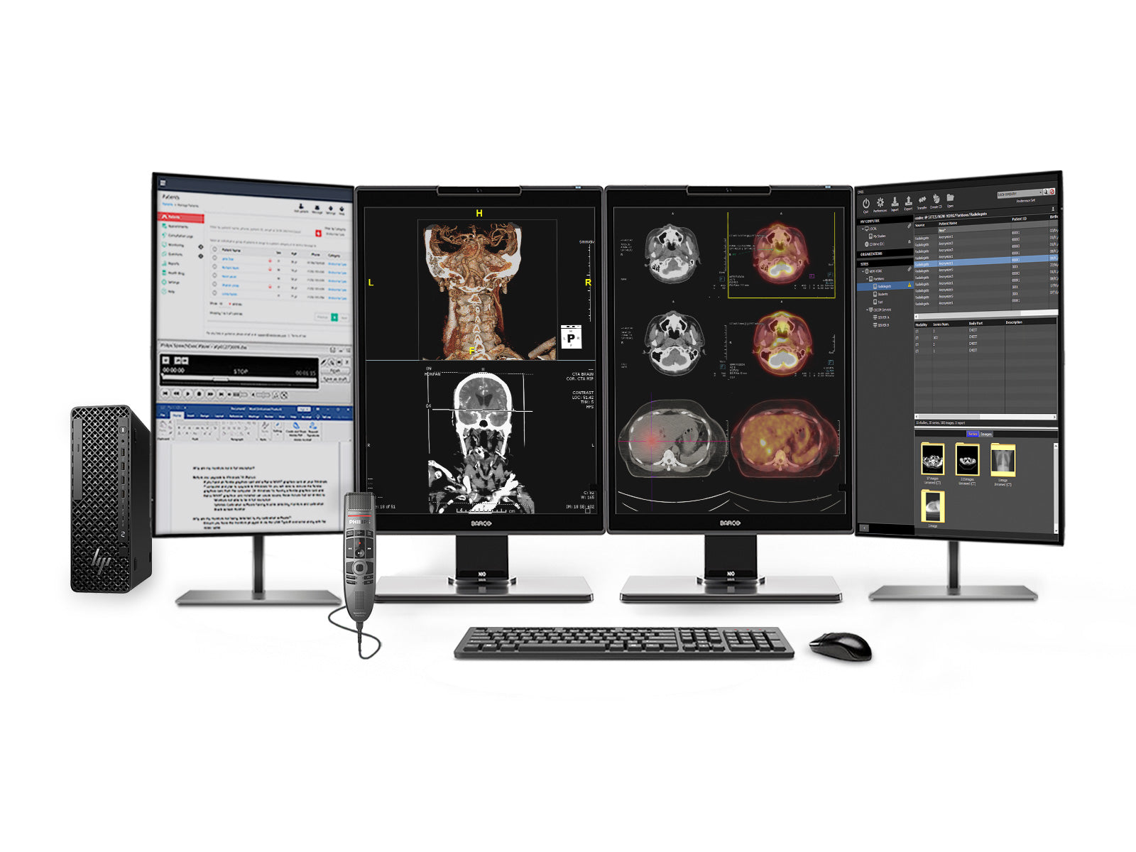 Complete PACS General Radiology Station | Barco 3MP Color LED MDNC-3521 | HP Z2 SFF G1i Workstation | Dictation Mic | Worklist Monitor (3521Z4G5)