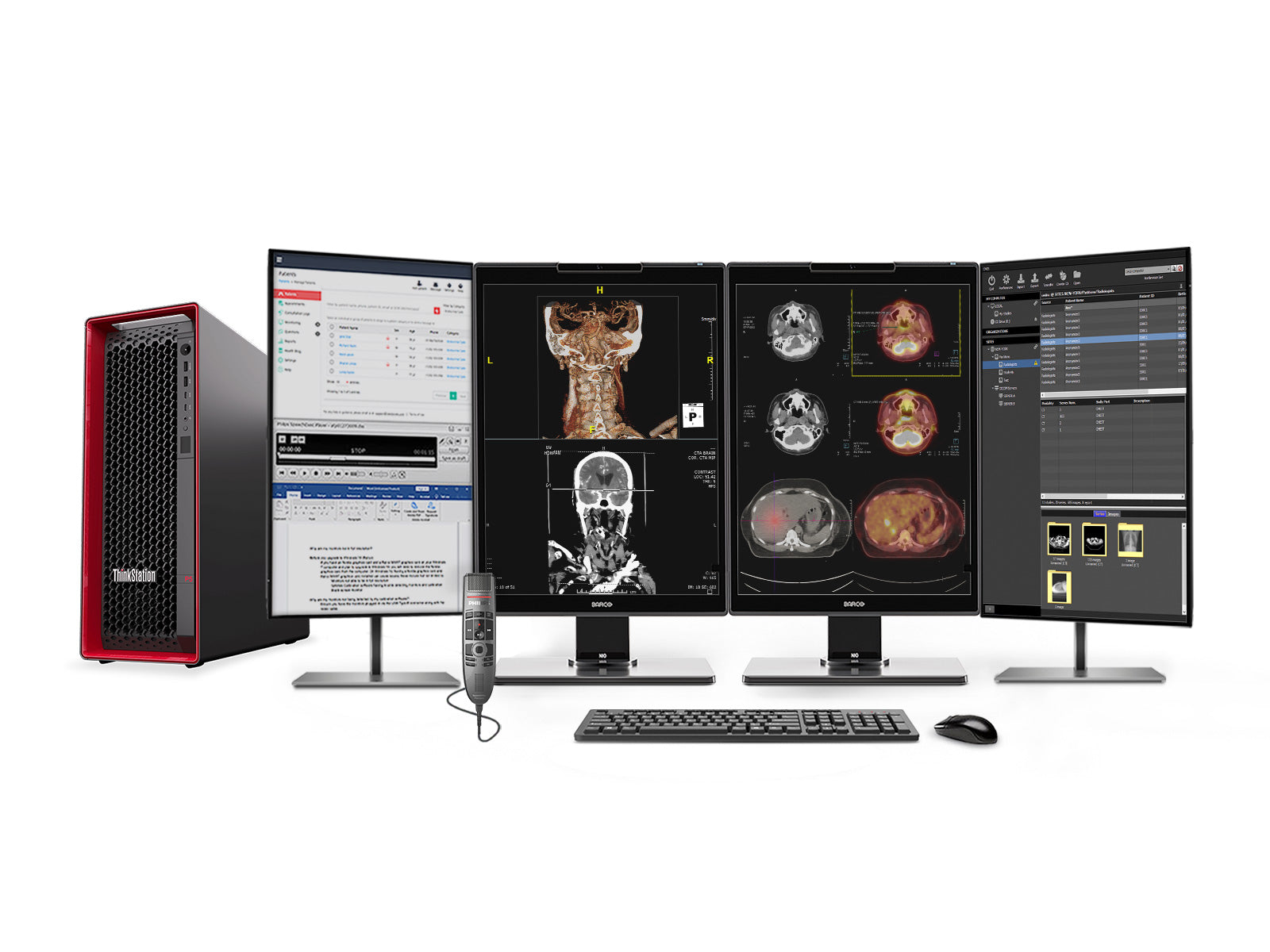 Complete PACS Algemene Radiologiestation | Barco 3MP Kleur LED MDNC-3521 | Lenovo P5 Werkstation | Dicteermicrofoon | Werklijstmonitor (3521Z4G5)