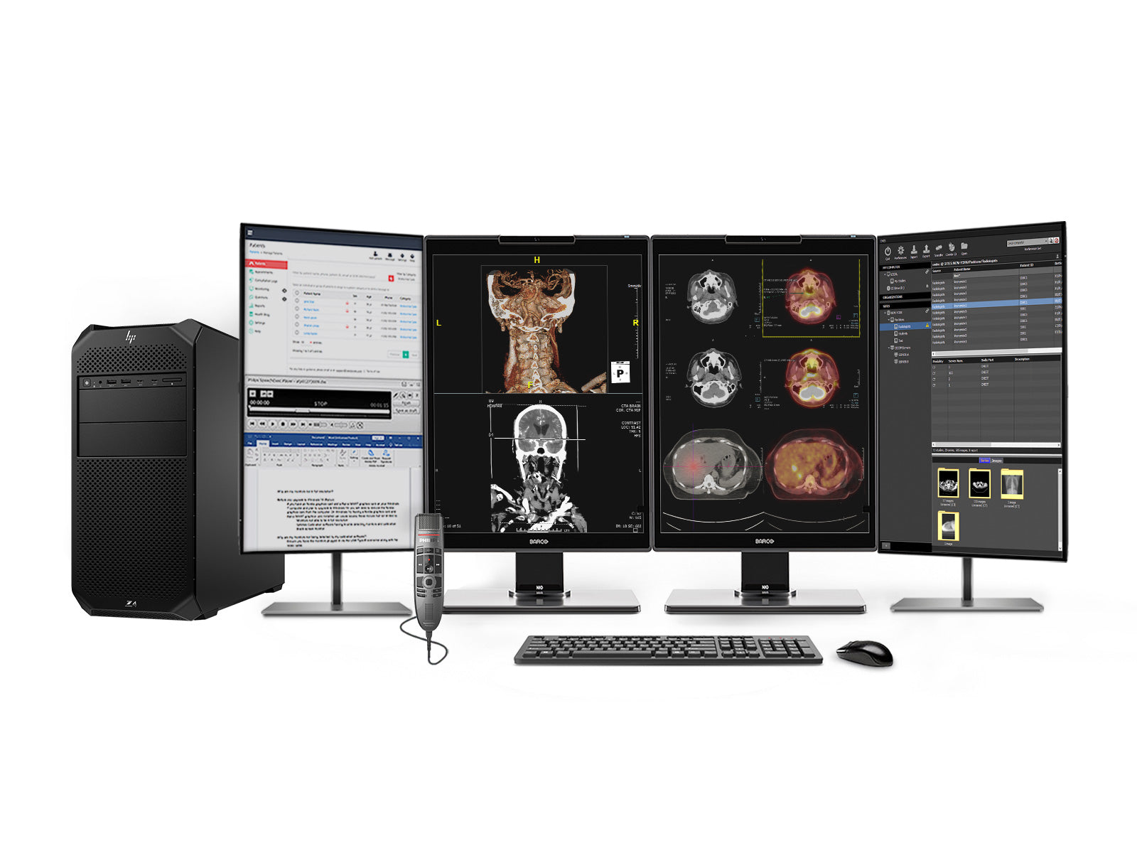 Complete PACS General Radiology Station | Barco 3MP Color LED MDNC-3521 | HP Z4 G5 Workstation | Dictation Mic | Worklist Monitor (3521Z4G5)