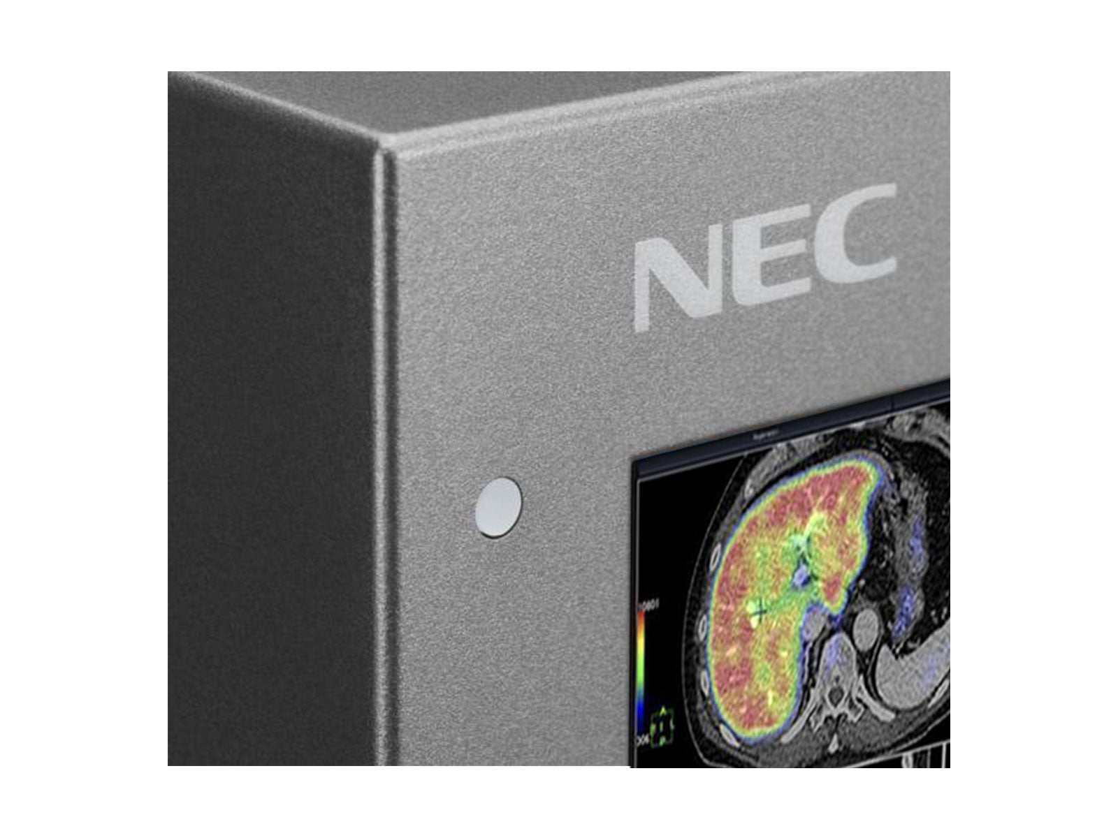 NEC MultiSync MD302C6 6MP 30 インチ一般放射線 PACS ディスプレイ (MD302C6)