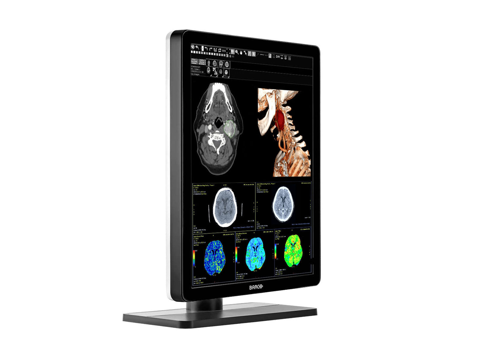 Barco Nio MDNC-3421 3MP 21" Color LED General Radiology PACS Display Monitors.com 
