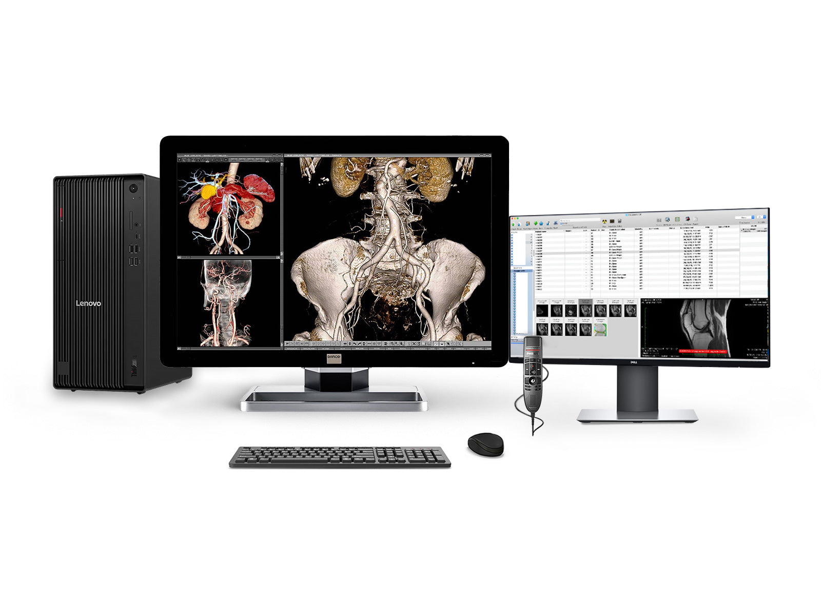 Complete PACS General Radiology Station | Barco Coronis MDCC-4330 4MP Color LED Display | Lenovo Workstation | Dictation Mic | Worklist Monitor (4330Z4R)