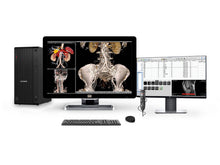 Stazione di radiologia generale PACS completa | Barco Coronis MDCC-4330 4MP Display LED a colori | HP Stazione di lavoro | Microfono per dettatura | Monitor lista di lavoro (4330Z4R)