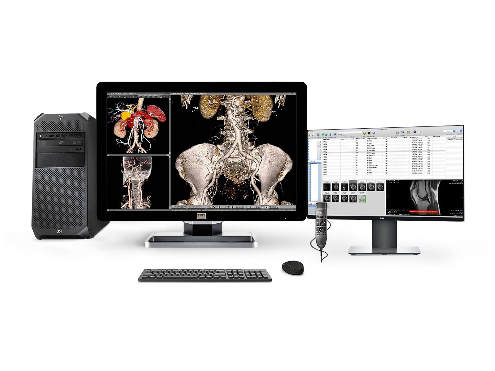 Bresco Pac Module Complete PACS General Radiology Station with HP Workstation