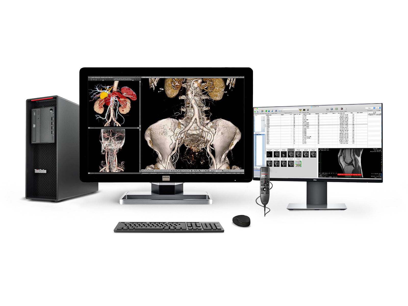 Complete PACS General Radiology Station | Barco Coronis MDCC-4330 4MP Color LED Display | Lenovo Workstation | Dictation Mic | Worklist Monitor (4330Z4R)