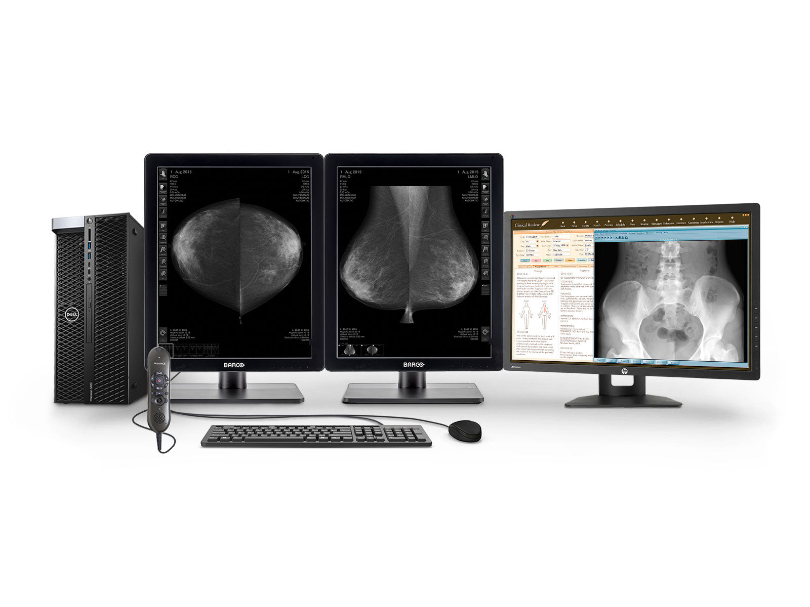 Station complète de lecture de mammographie | Barco Moniteur LED en niveaux de gris 5MP | Poste de travail Dell | Micro de dictée | Moniteur de liste de travail (5221Z24X)