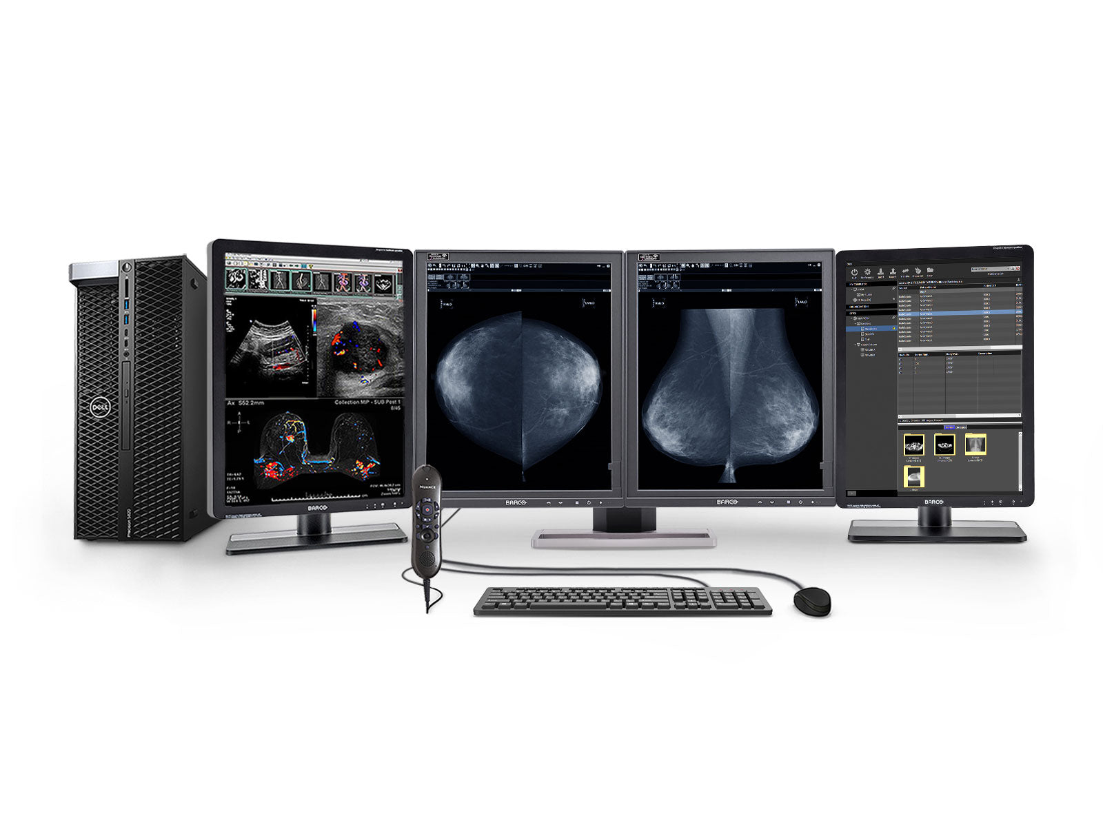 Station complète de lecture de mammographie | Barco Moniteur LED en niveaux de gris 5MP | Poste de travail Dell | Micro de dictée | Moniteurs de liste de travail (5221Z4)