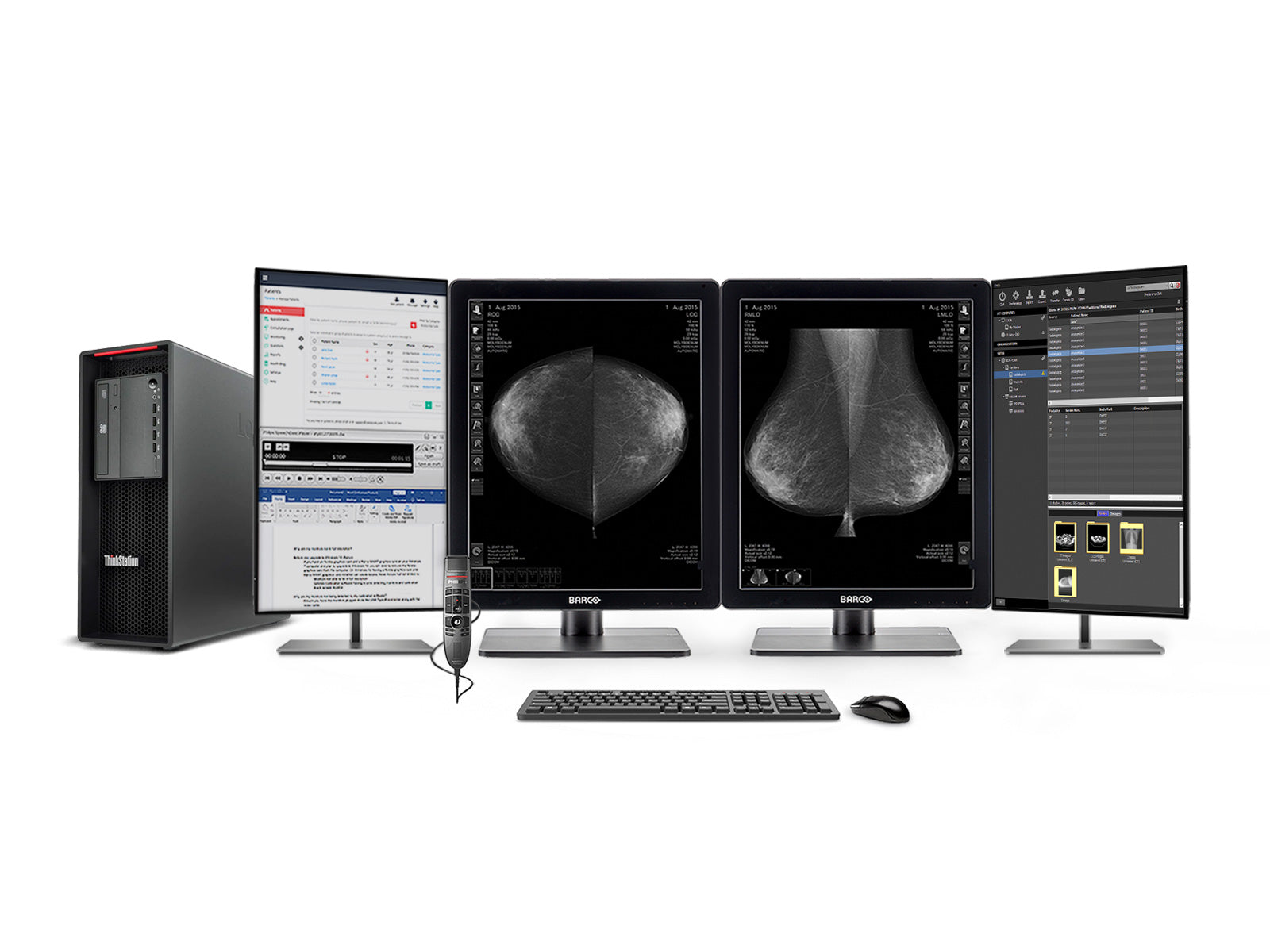 Complete Mammography Reading Station | Barco MDNG-5221 5MP Grayscale LED Monitors | Lenovo Workstation | Dictation Mic | Worklist Monitor (5221Z4R)