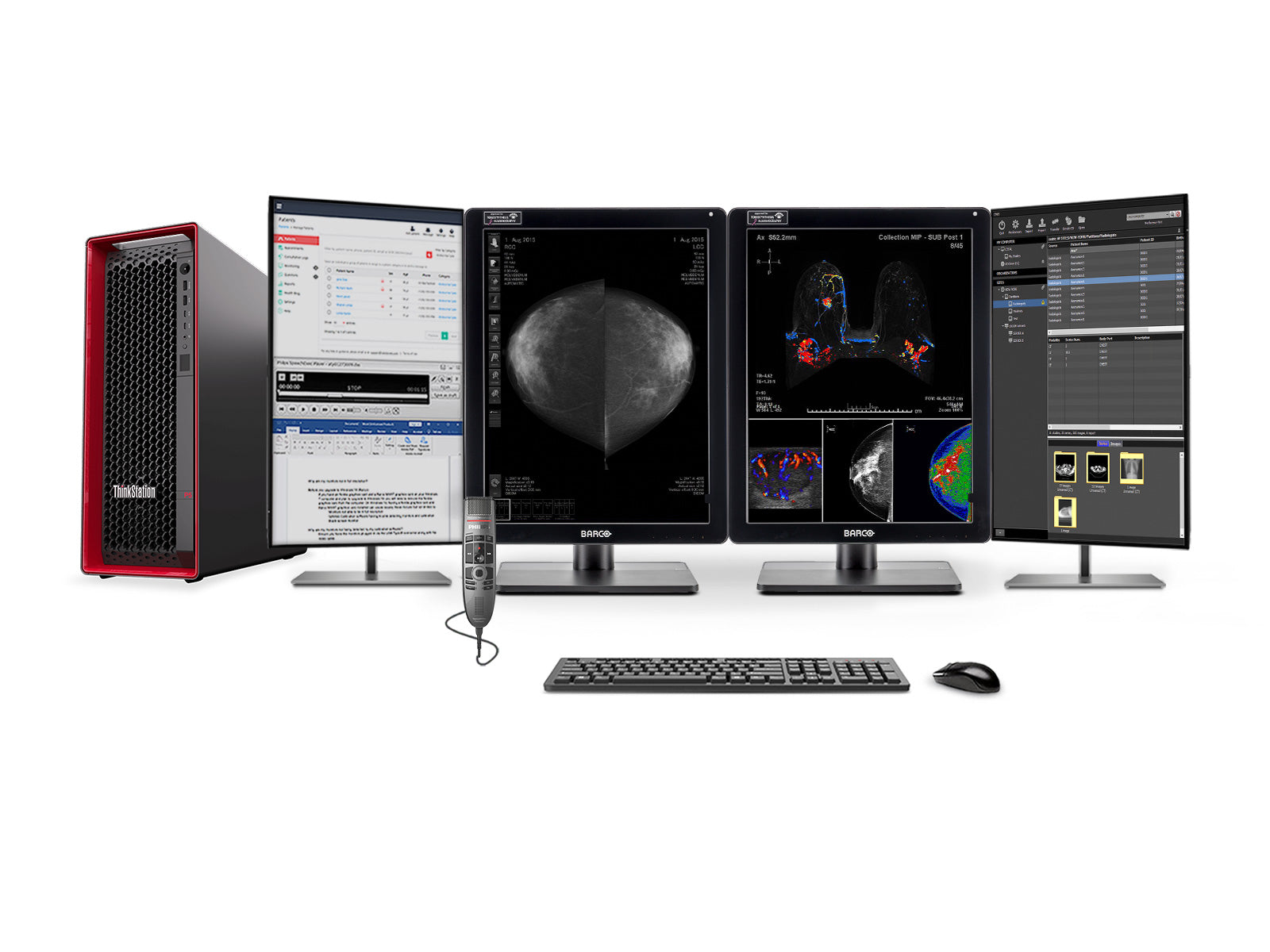 Complete Mammography Reading Station | Barco 5MP MDNC-6121 Color LED Monitors | Lenovo P5 Workstation | Dictation Mic | Worklist Monitors (61212221)