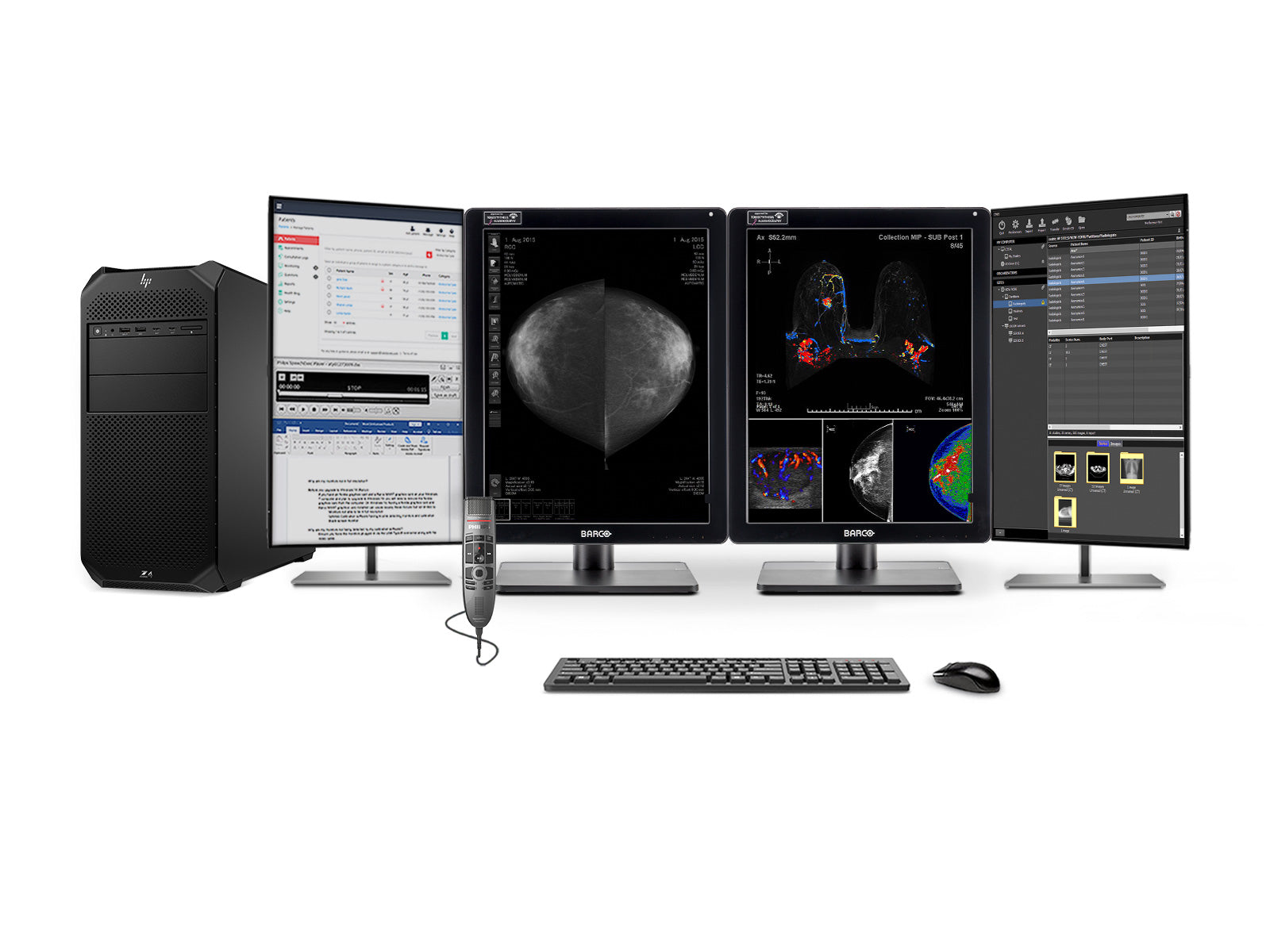 Stazione di Lettura Mammografica Completa | Barco 5MP Monitor LED a Colori MDNC-6121 | HP Z4 G5 Postazione di Lavoro | Microfono di Dettatura | Monitor della Lista di Lavoro (61212221) 