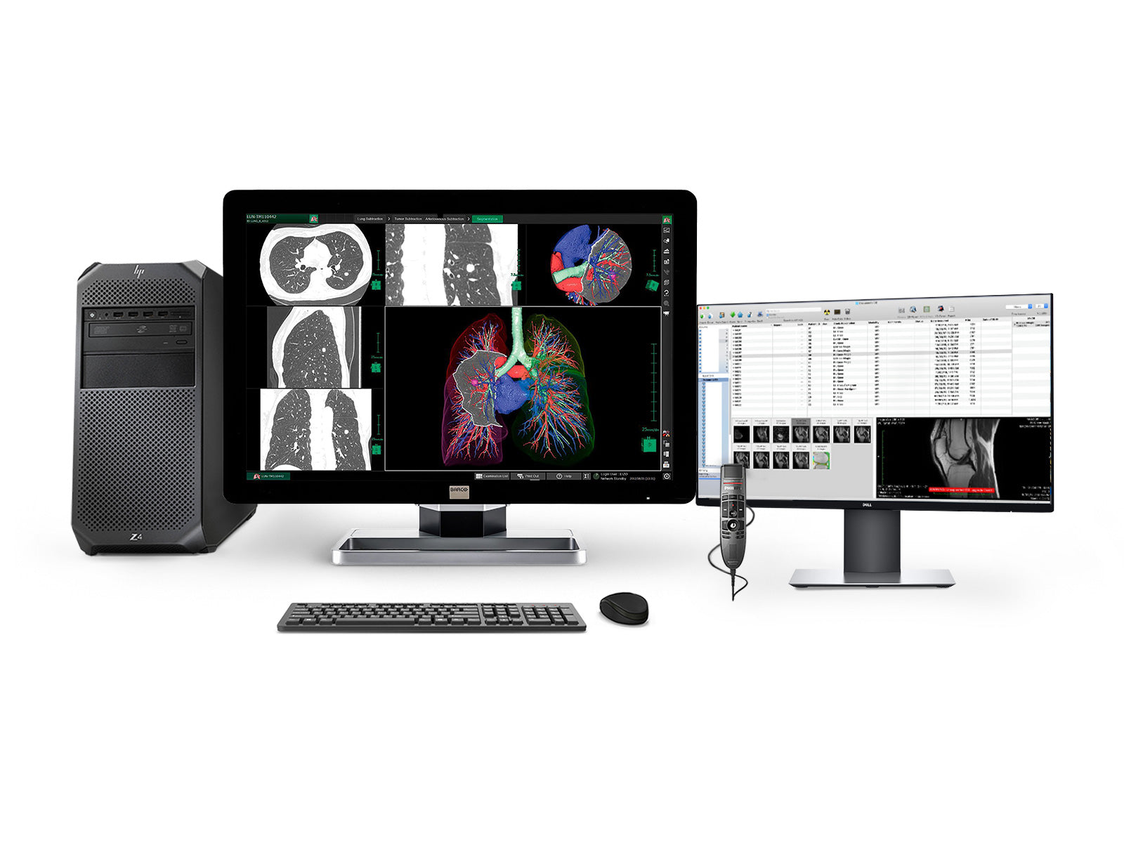 Bresco Pac Module Complete PACS Radiology Workstation - Barco & HP