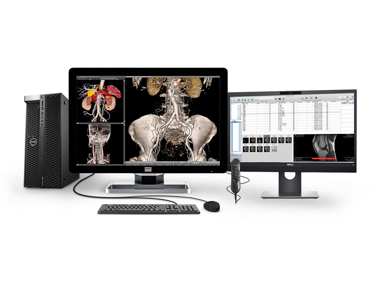Complete PACS General Radiology Station | Barco 6MP Color LED Display | Dell Workstation | Dictation Mic | Worklist Monitor (6230Z6R)